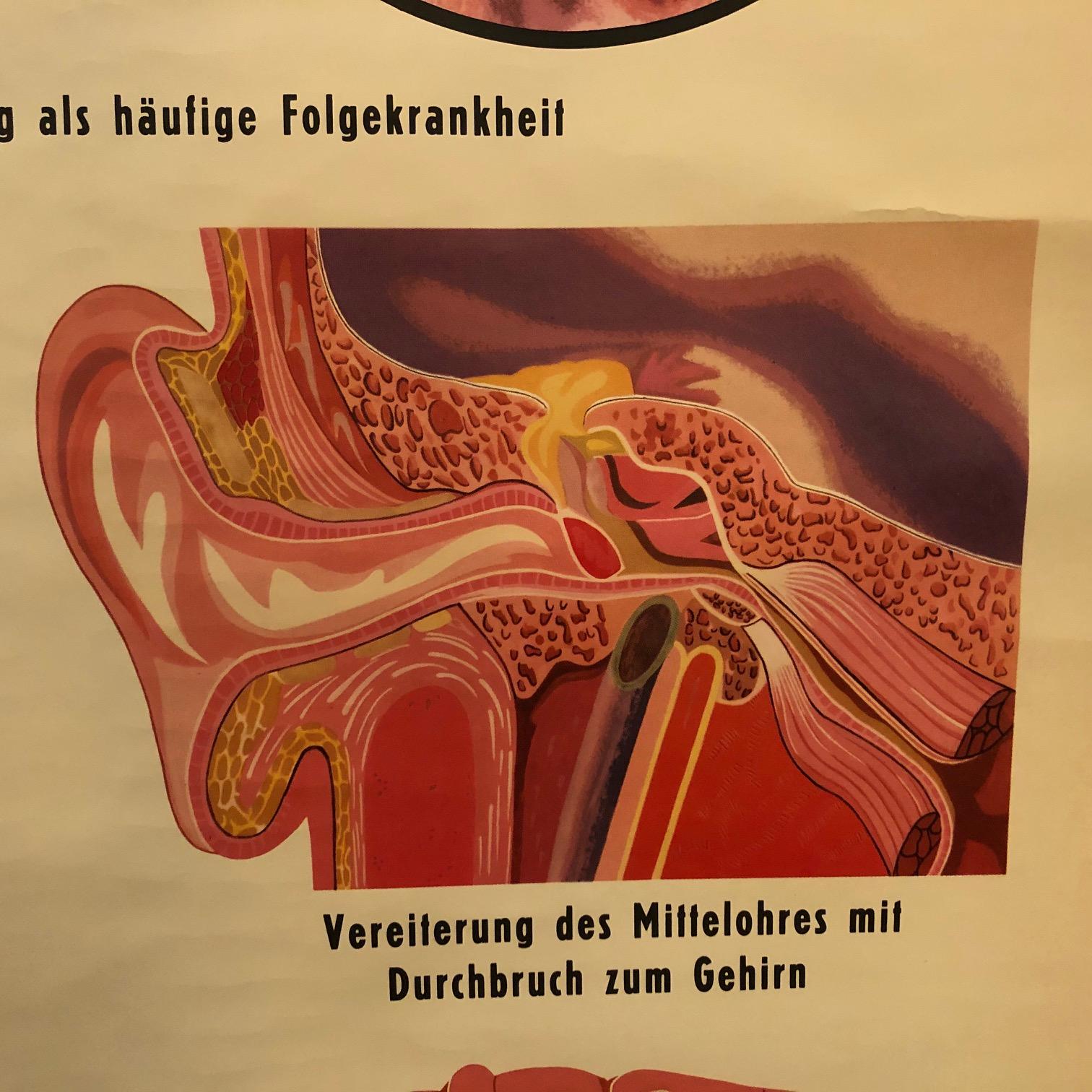 20th Century German Educational Anatomical Sepsis Study Chart For Sale