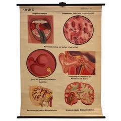 Used German Educational Anatomical Sepsis Study Chart