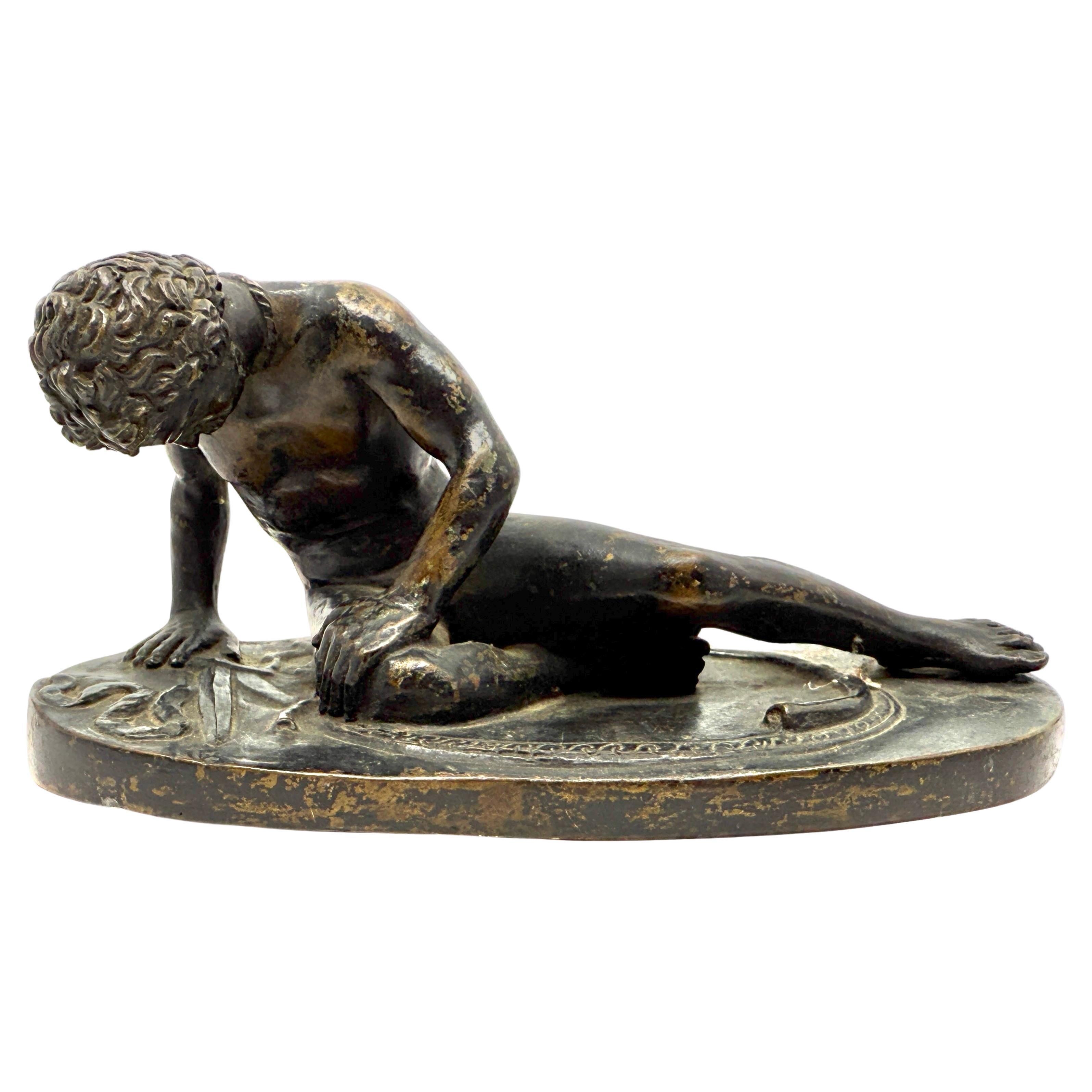What is around The Dying Gaul’s neck?