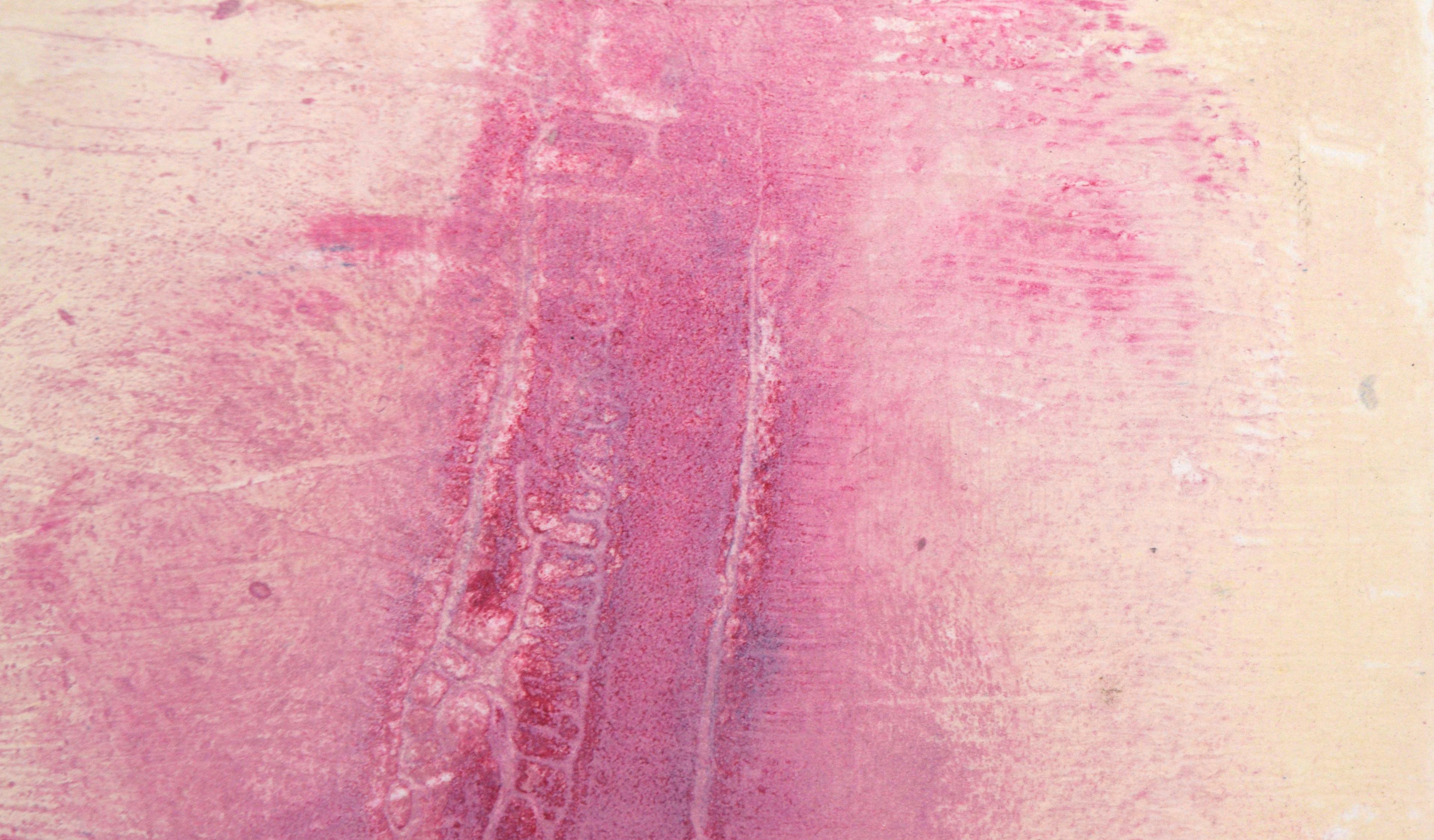 Pink on Yellow - Textured Transfer Monotype in Oil on Paper - Abstract Expressionist Print by Heather Speck