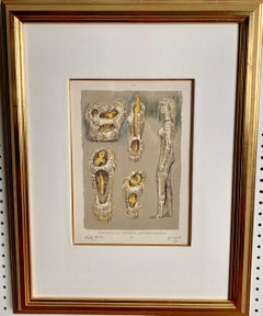 Pandora and The Imprisoned Statues