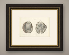 Horizontal Sections of the Cerebrum, Antique Hirschfeld Anatomy Print, 1866