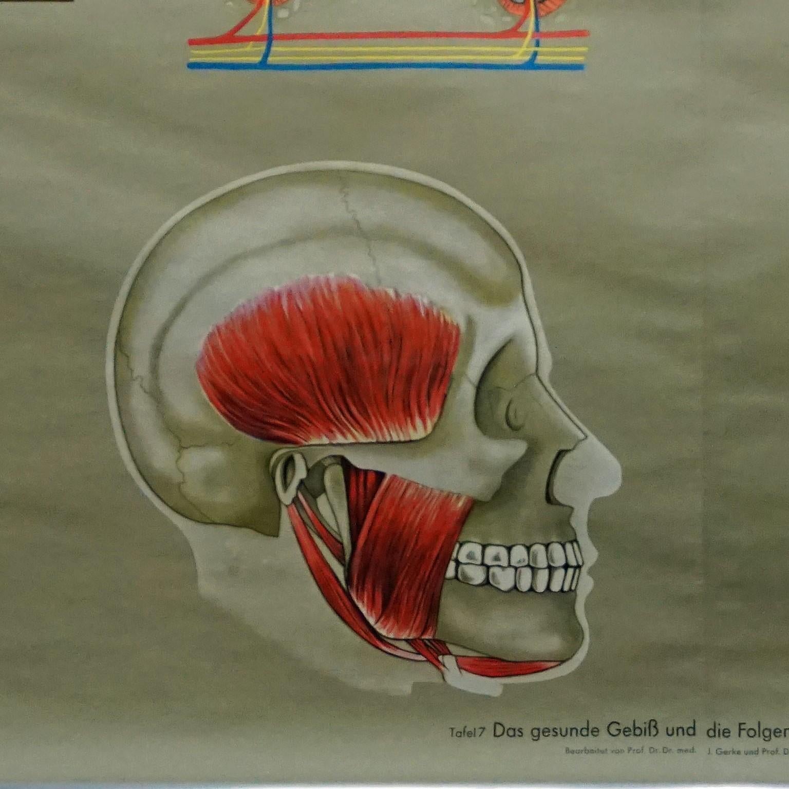 menschlicher Körper, Wandplakat, Rollbarer Wanddruck, healthy Teeth, Jaw Head im Zustand „Gut“ im Angebot in Berghuelen, DE