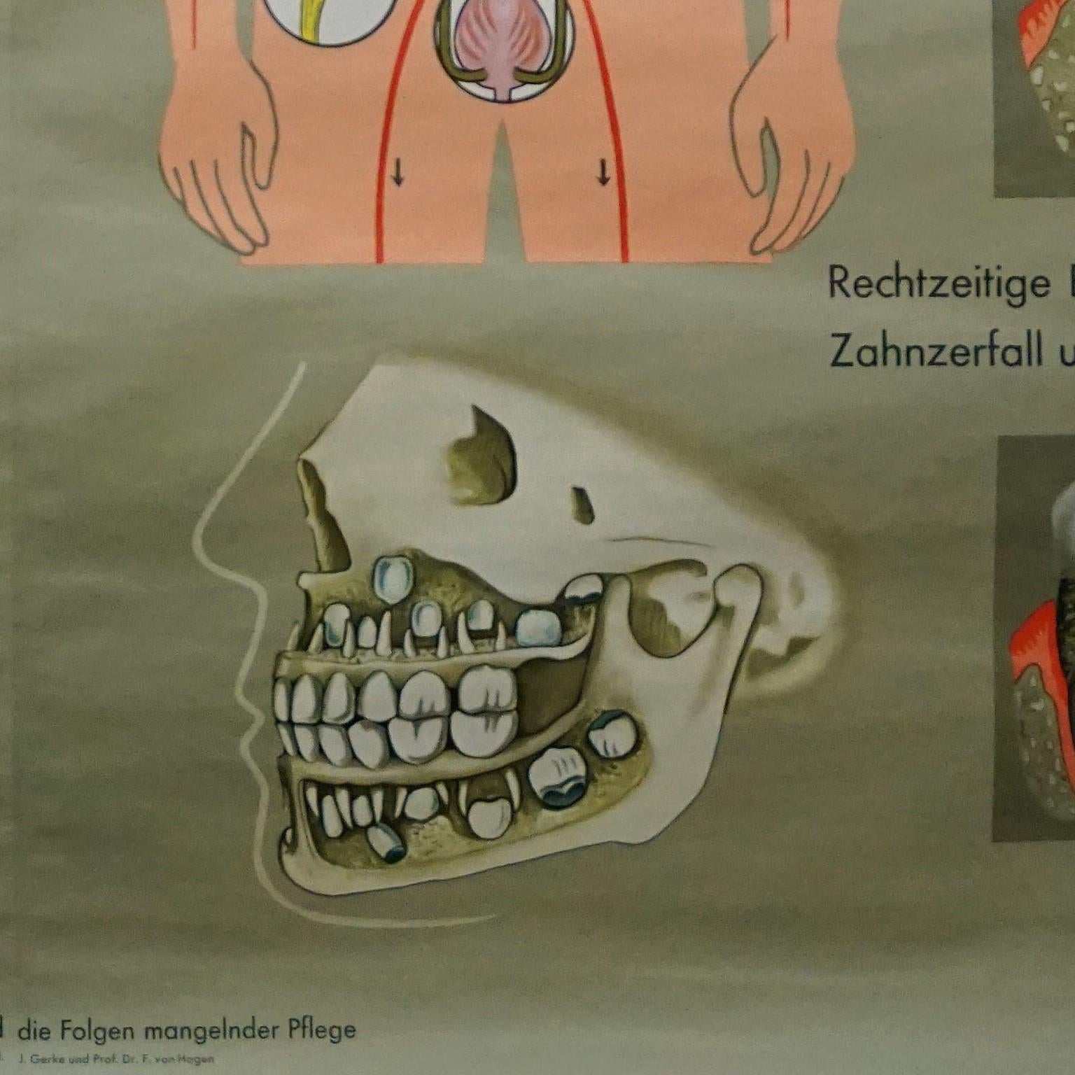 menschlicher Körper, Wandplakat, Rollbarer Wanddruck, healthy Teeth, Jaw Head (20. Jahrhundert) im Angebot