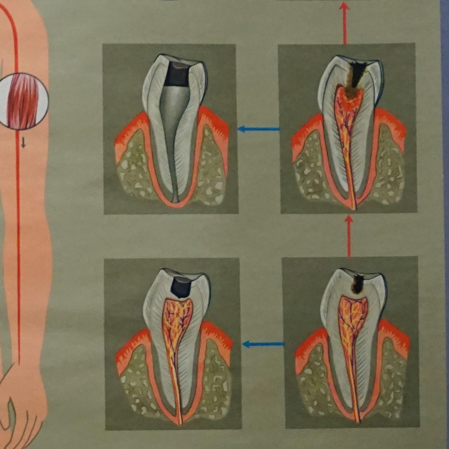 menschlicher Körper, Wandplakat, Rollbarer Wanddruck, healthy Teeth, Jaw Head (Leinwand) im Angebot