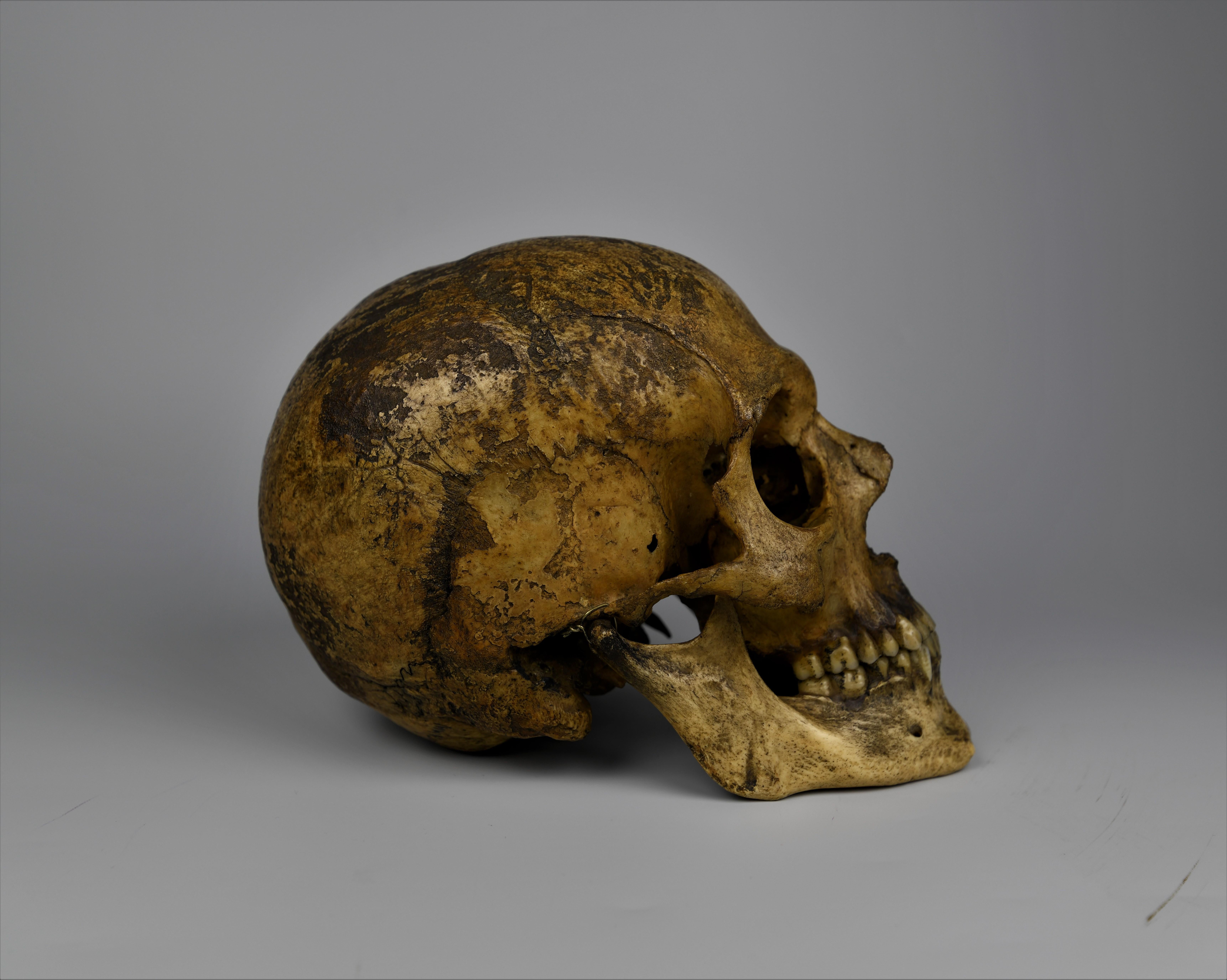 mesopotamia skull