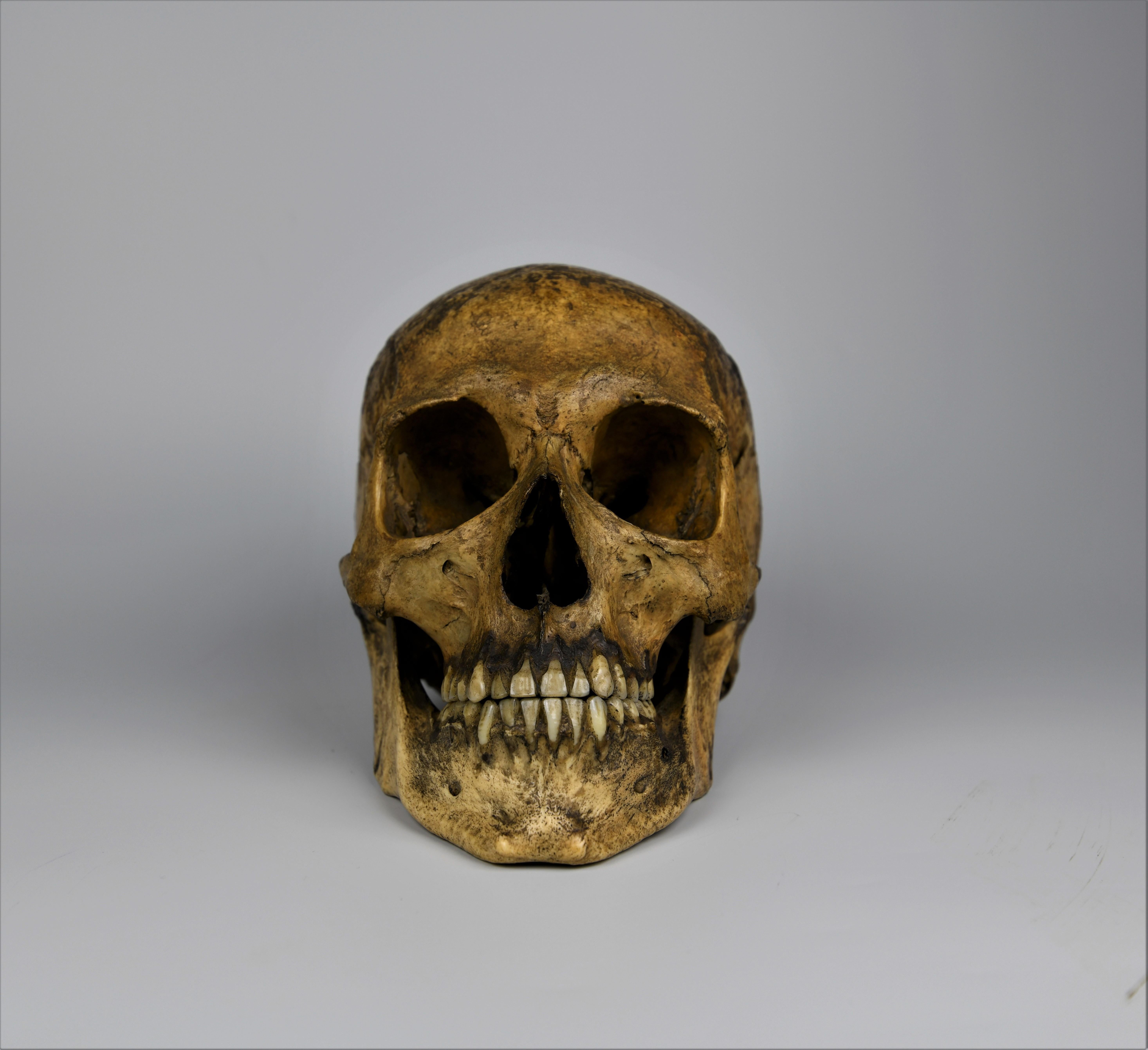 West Asian Human Medical Skull 19th Century Mesopotamian