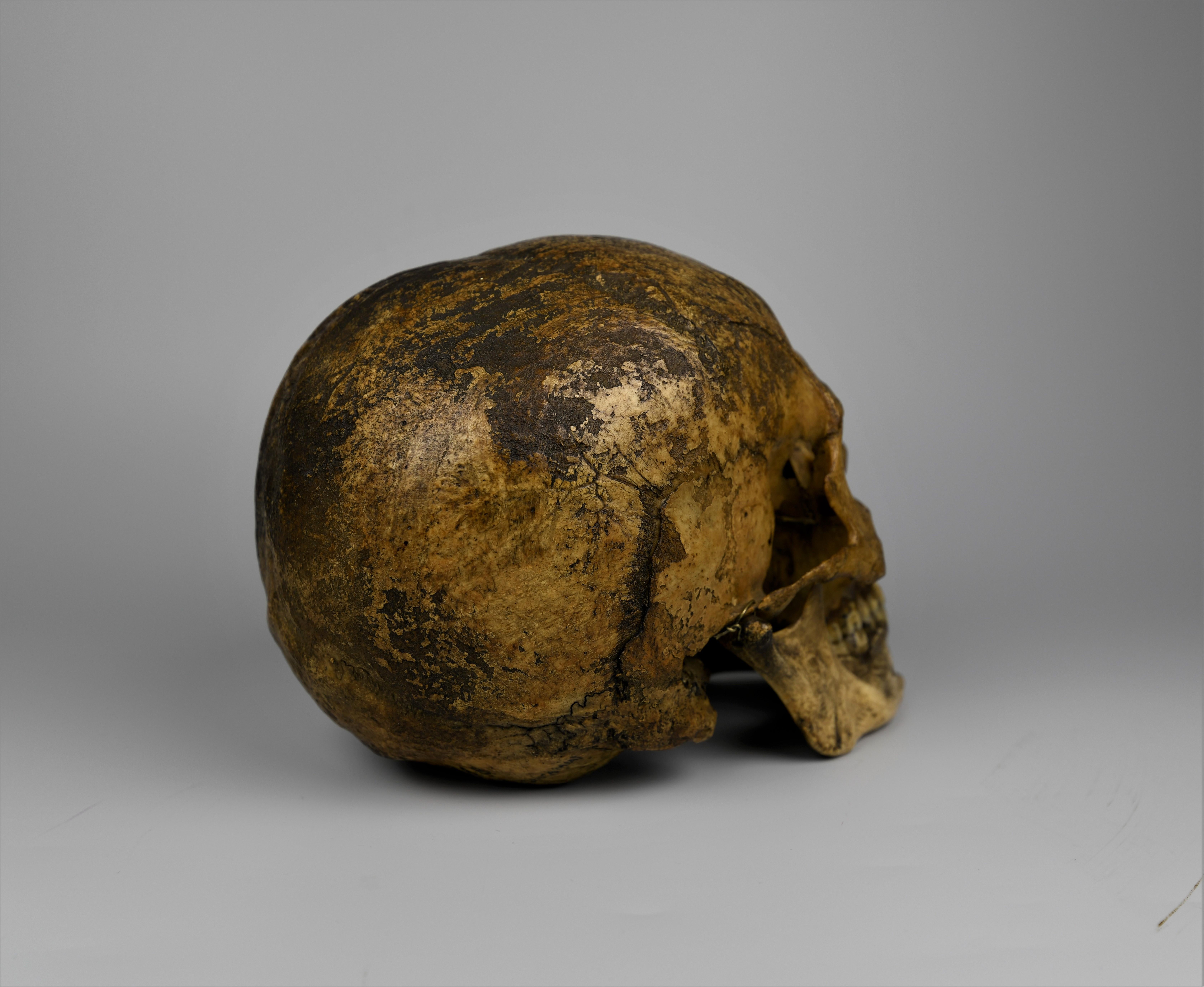 Human Medical Skull 19th Century Mesopotamian In Good Condition In everton lymington, GB