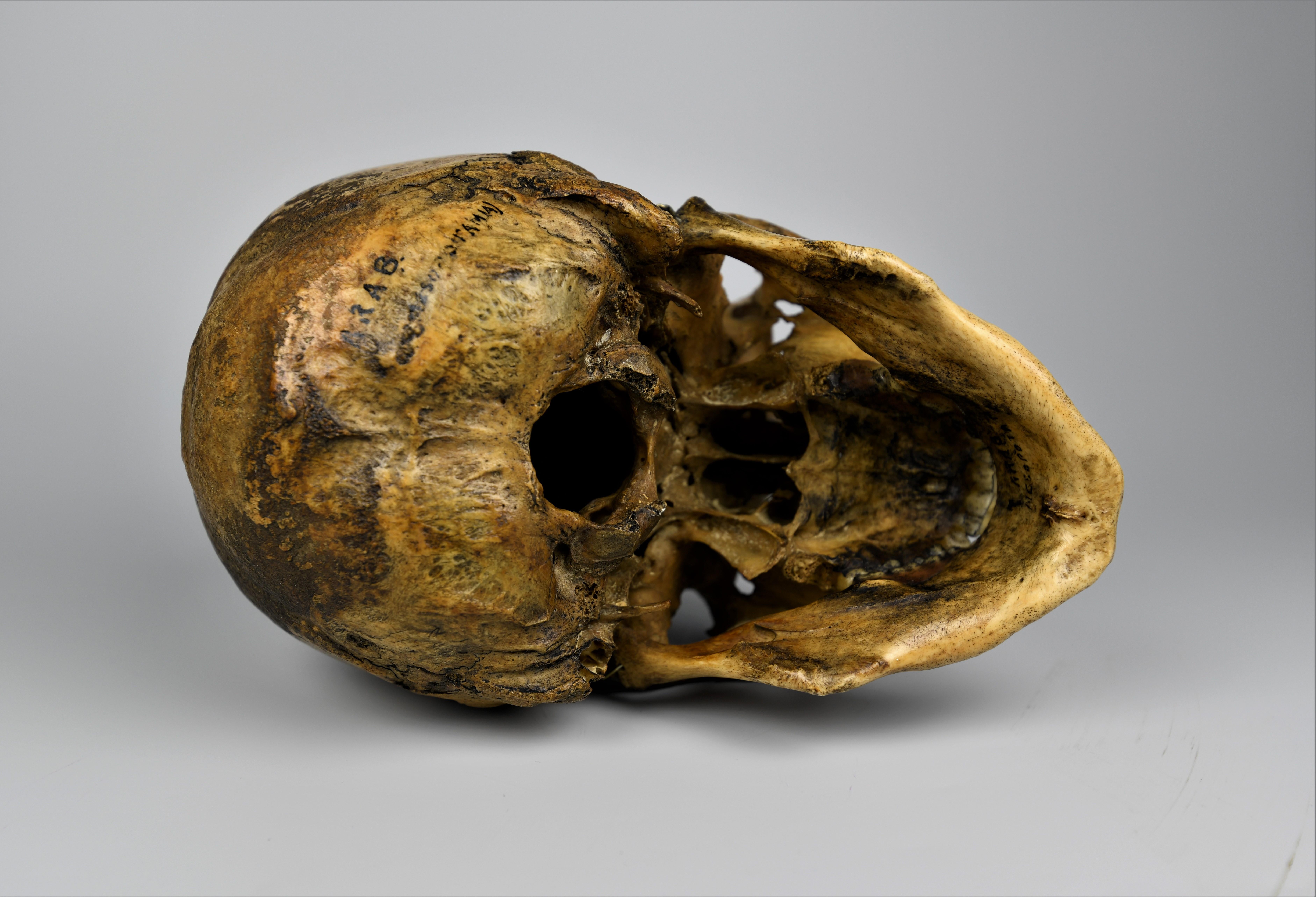Human Medical Skull 19th Century Mesopotamian 1