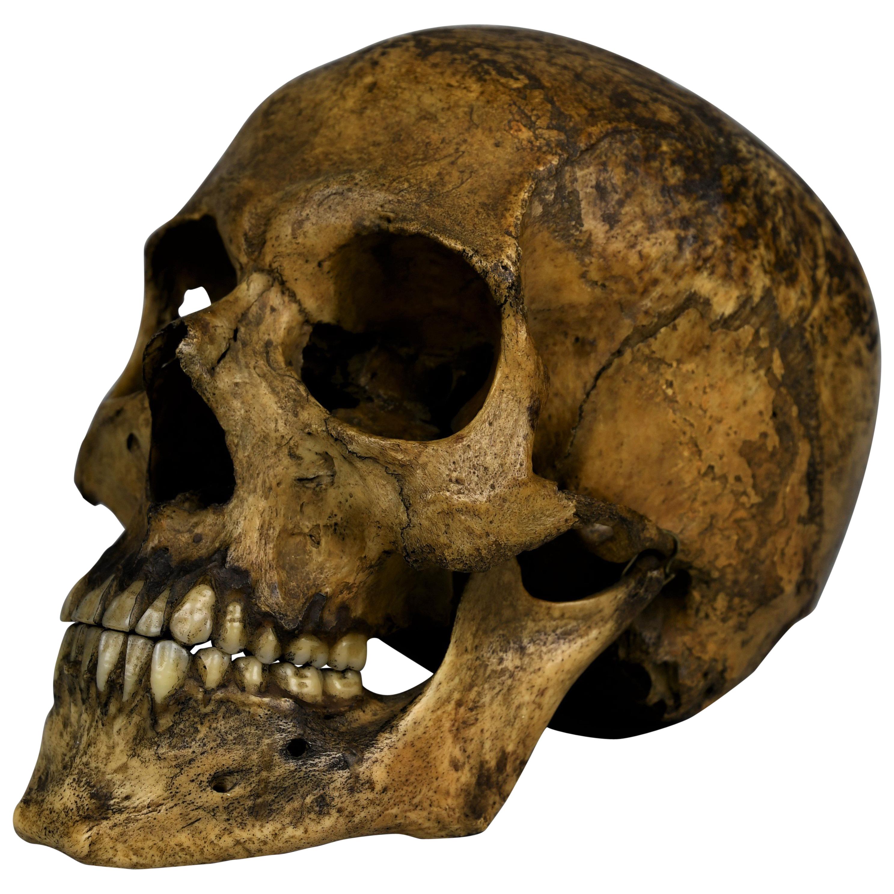 Human Medical Skull 19th Century Mesopotamian