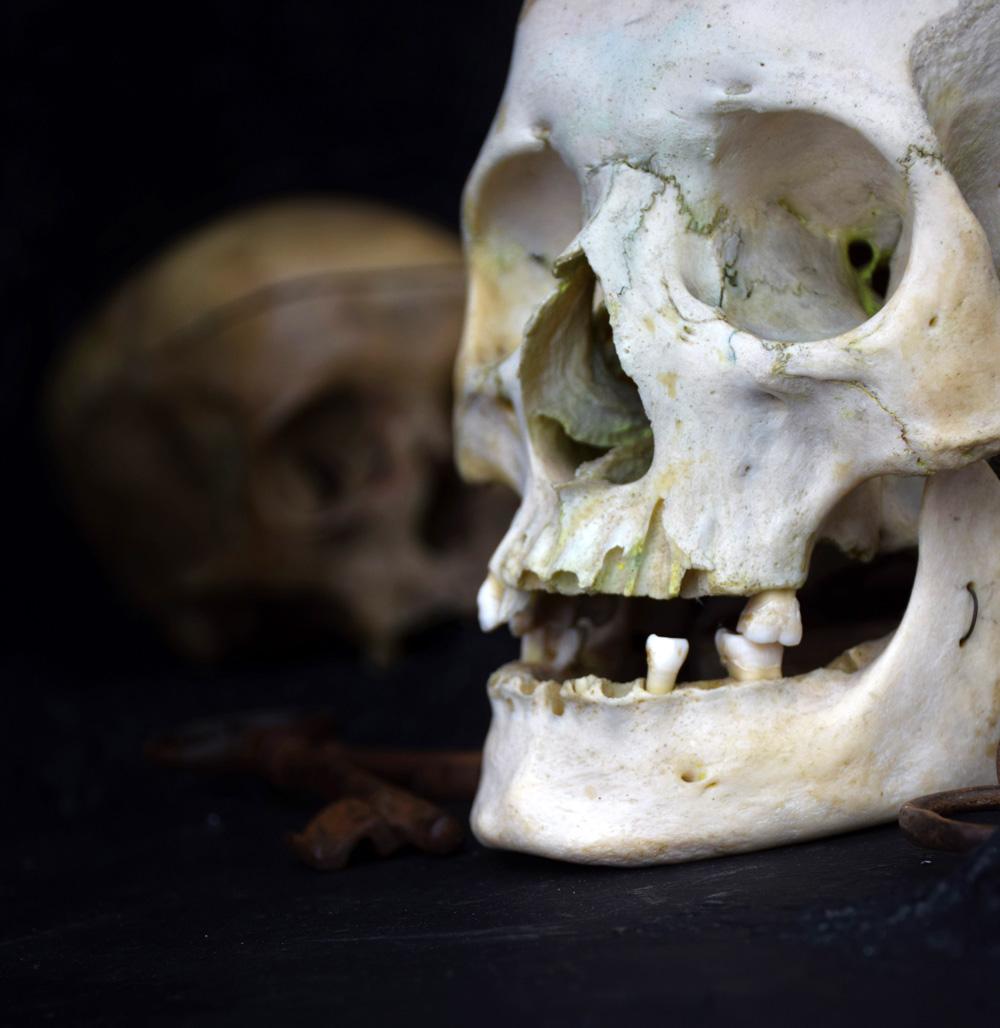 Antiker menschlicher Schädel 0.2

Zum Verkauf steht ein wunderschönes Exemplar eines antiken menschlichen Schädels:: das kürzlich von einer medizinischen Schule in Nordengland erworben wurde. Dieser Schädel ist in insgesamt gutem Zustand und in