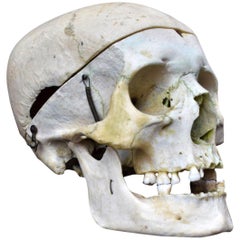 Human Skull example 0.2