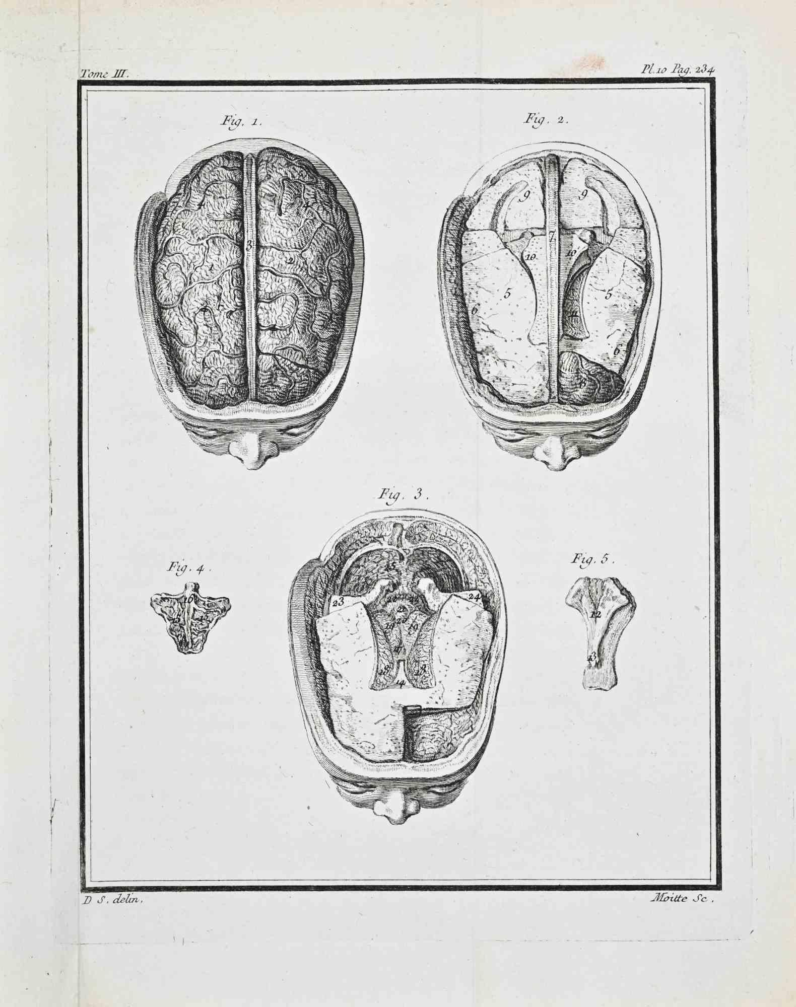 Plate from Buffon's Histoire Naturelle, Tome III – Pl. 10, p. 234

This copperplate engraving presents a systematic anatomical study of the human brain through multiple cranial sections. The plate comprises five figures, each illustrating a