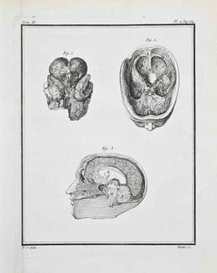 Studi anatomici - Cervello umano - Acquaforte di Jacques Baron - 1771