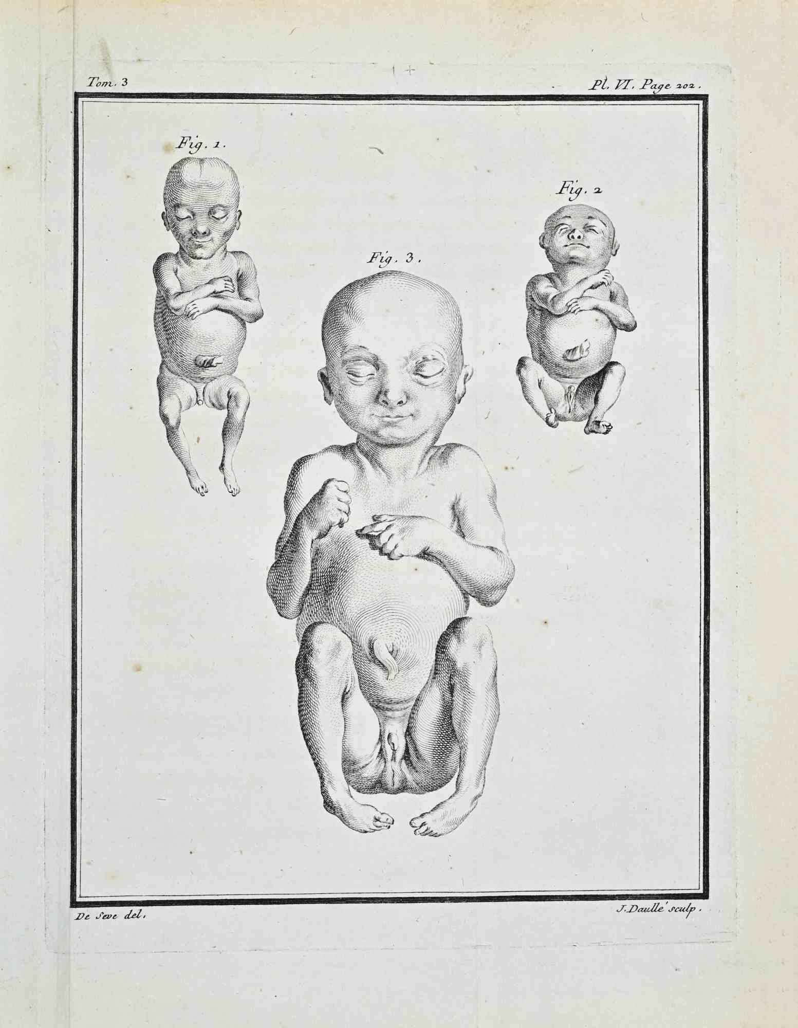 Jacques de Seve Figurative Print - Anatomical Studies - Etching by Jacques de Sève - 1771