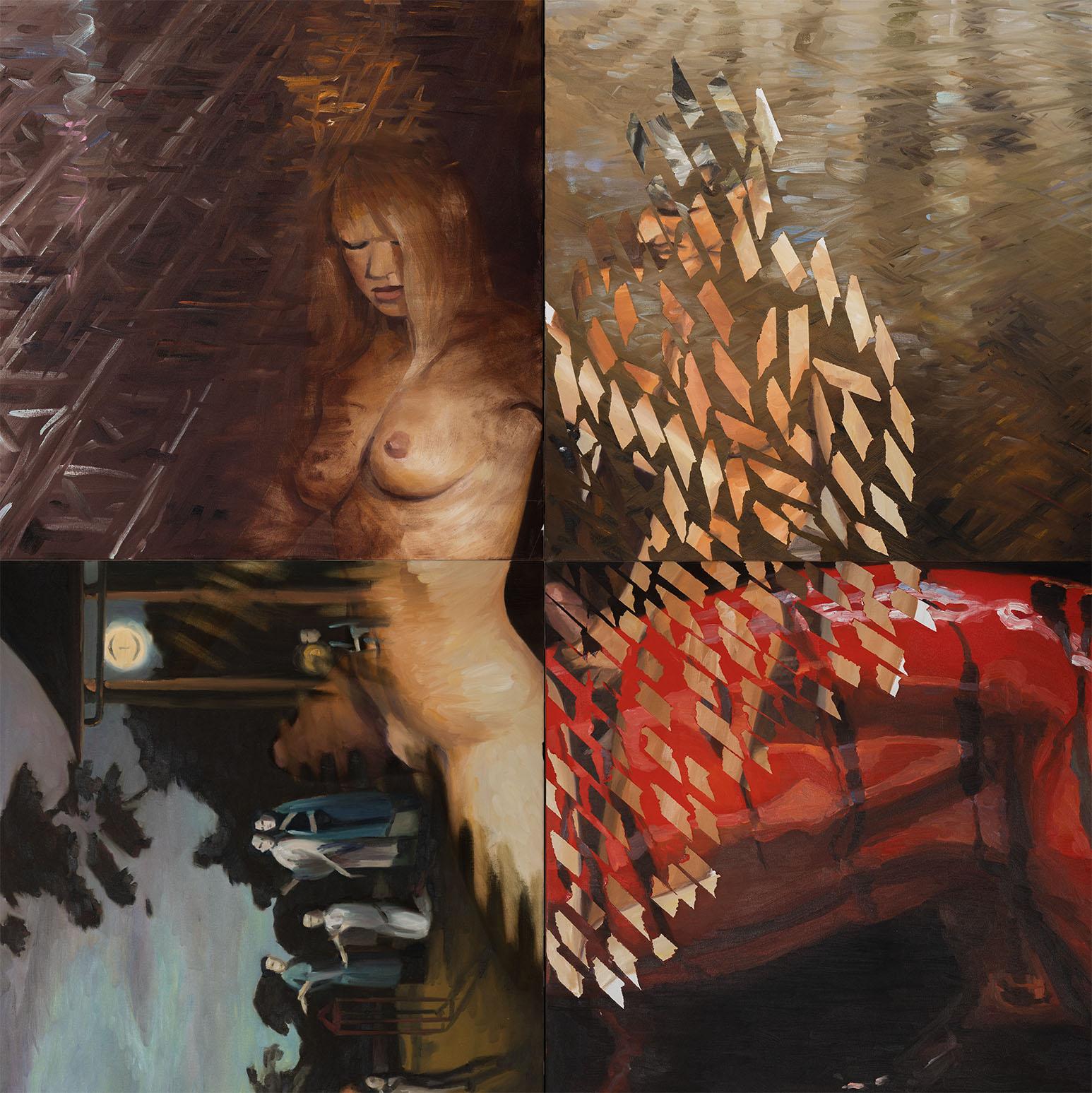 Psychic Surgery: Triple Bypass - Realist Painting by Joanne Tod