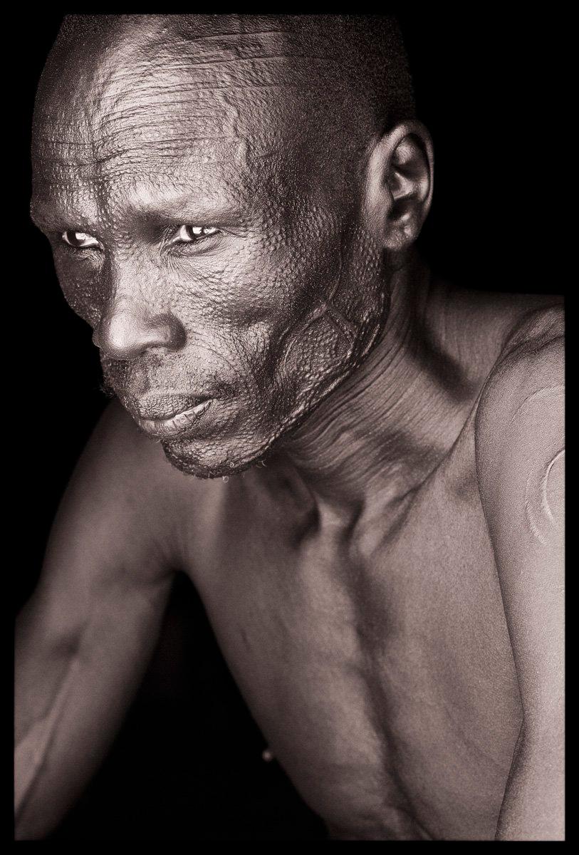 This Nuer man from the far west of Ethiopia was displaced from South Sudan.  He has the characteristic six forehead line scars of his group and the most beautiful pattern of dots and curved forms I came across in this region. Facial scarring as