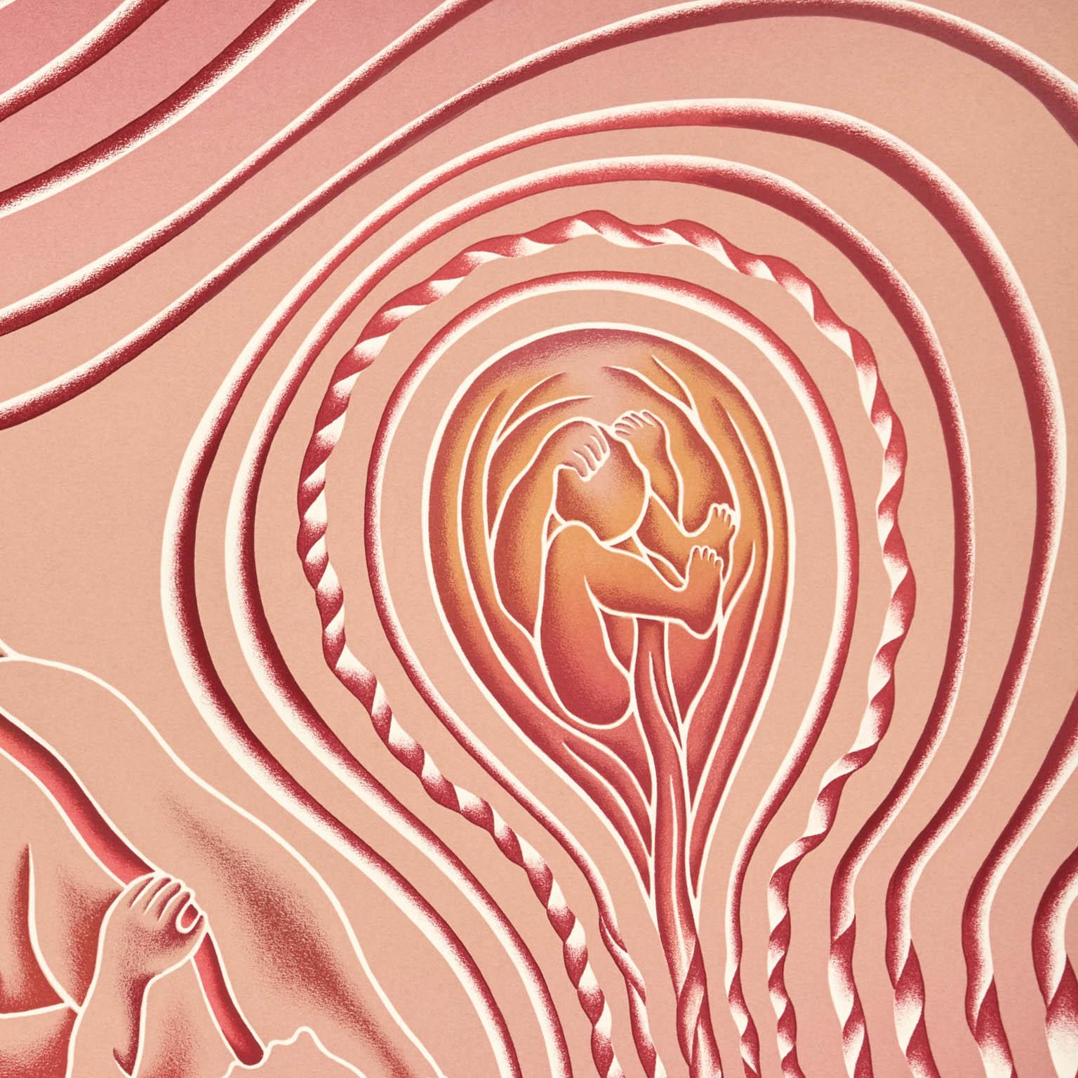 Lacerazione/strappo da parto - Figurative Print Beige di Judy Chicago