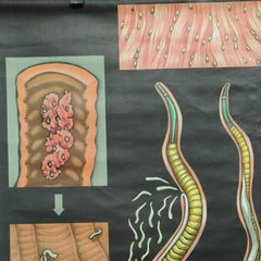 Jung Koch Quentell Rollable Poster Print Wall Chart Trichina