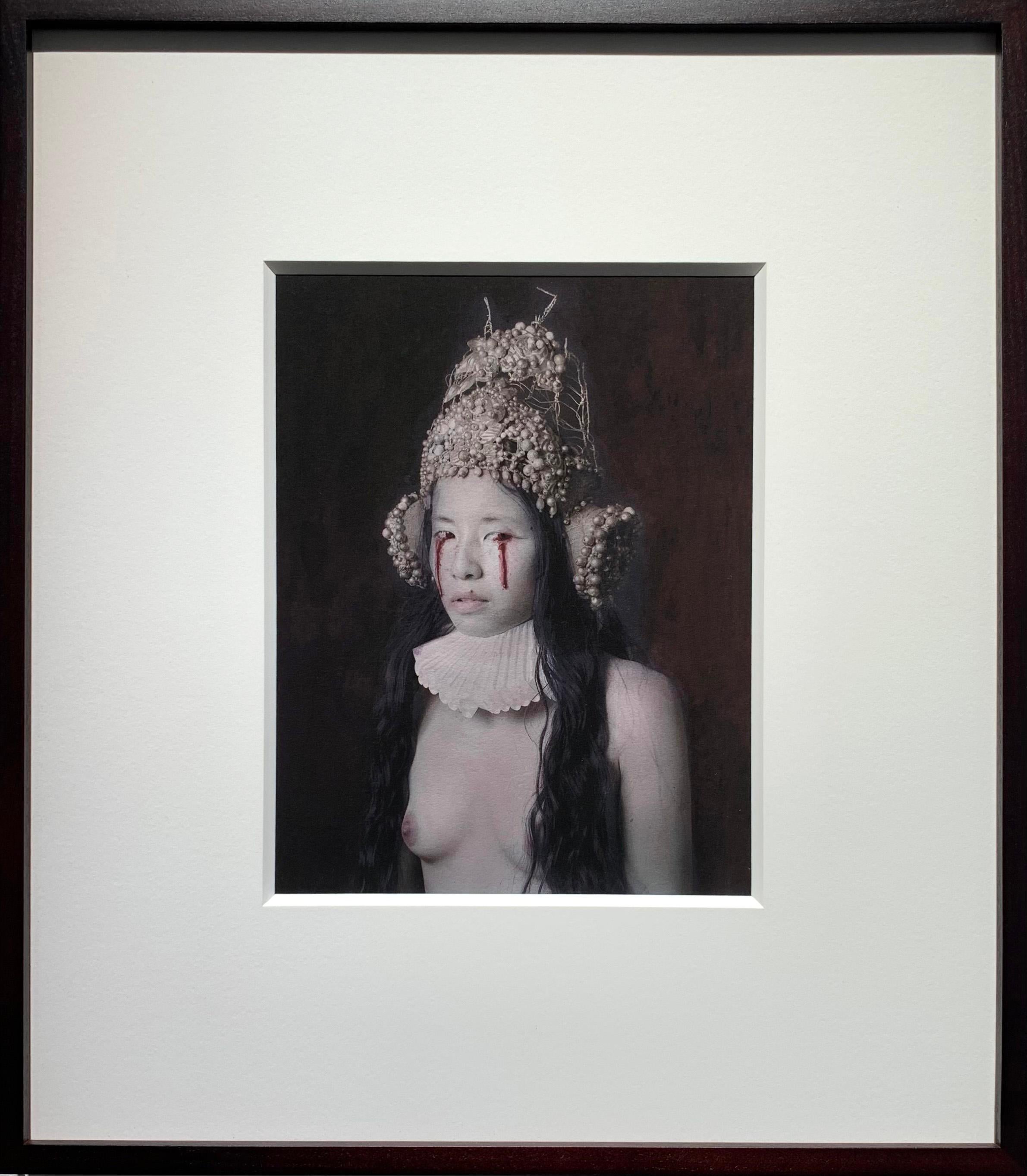 Eye Infection As A result Of Ingesting Poison - Druck des handkolorierten Fotos – Print von Katie Eleanor