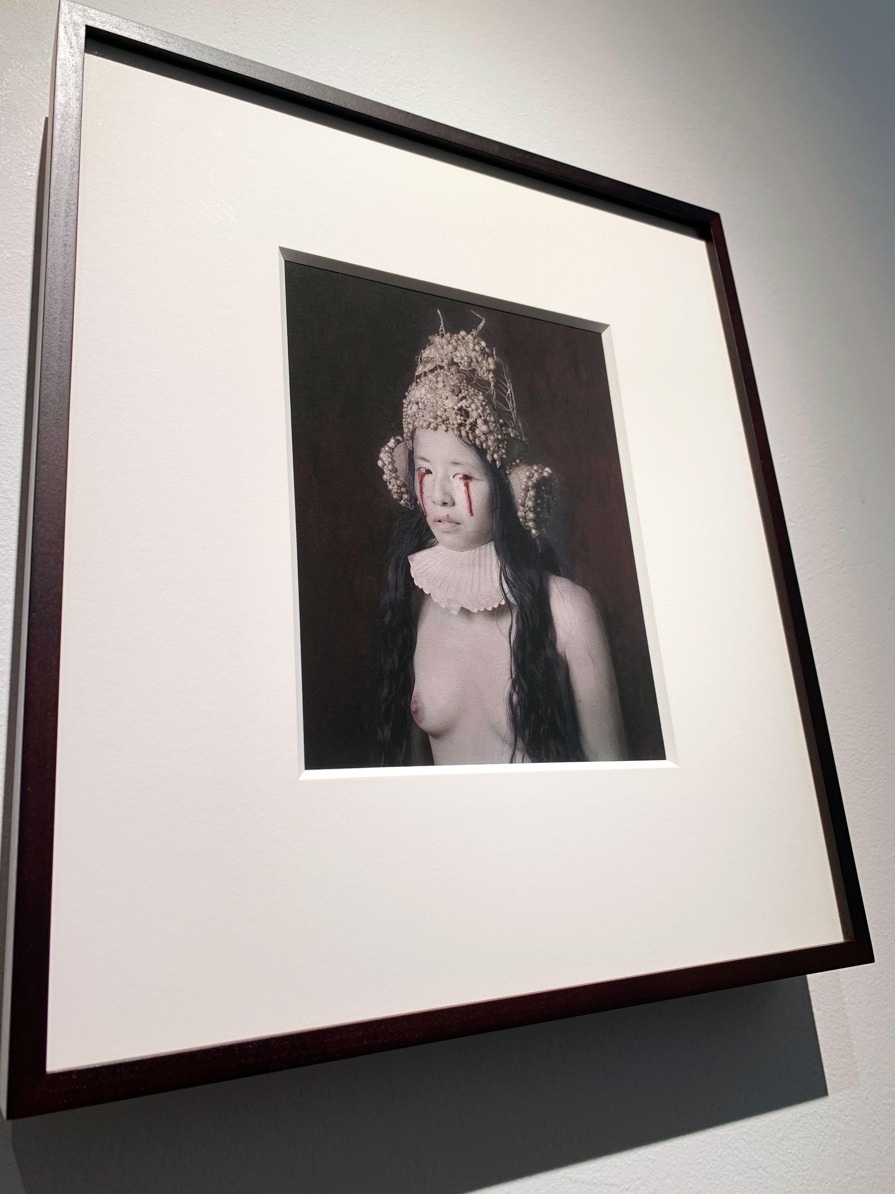 Eye Infection As A result Of Ingesting Poison - Druck des handkolorierten Fotos im Angebot 3