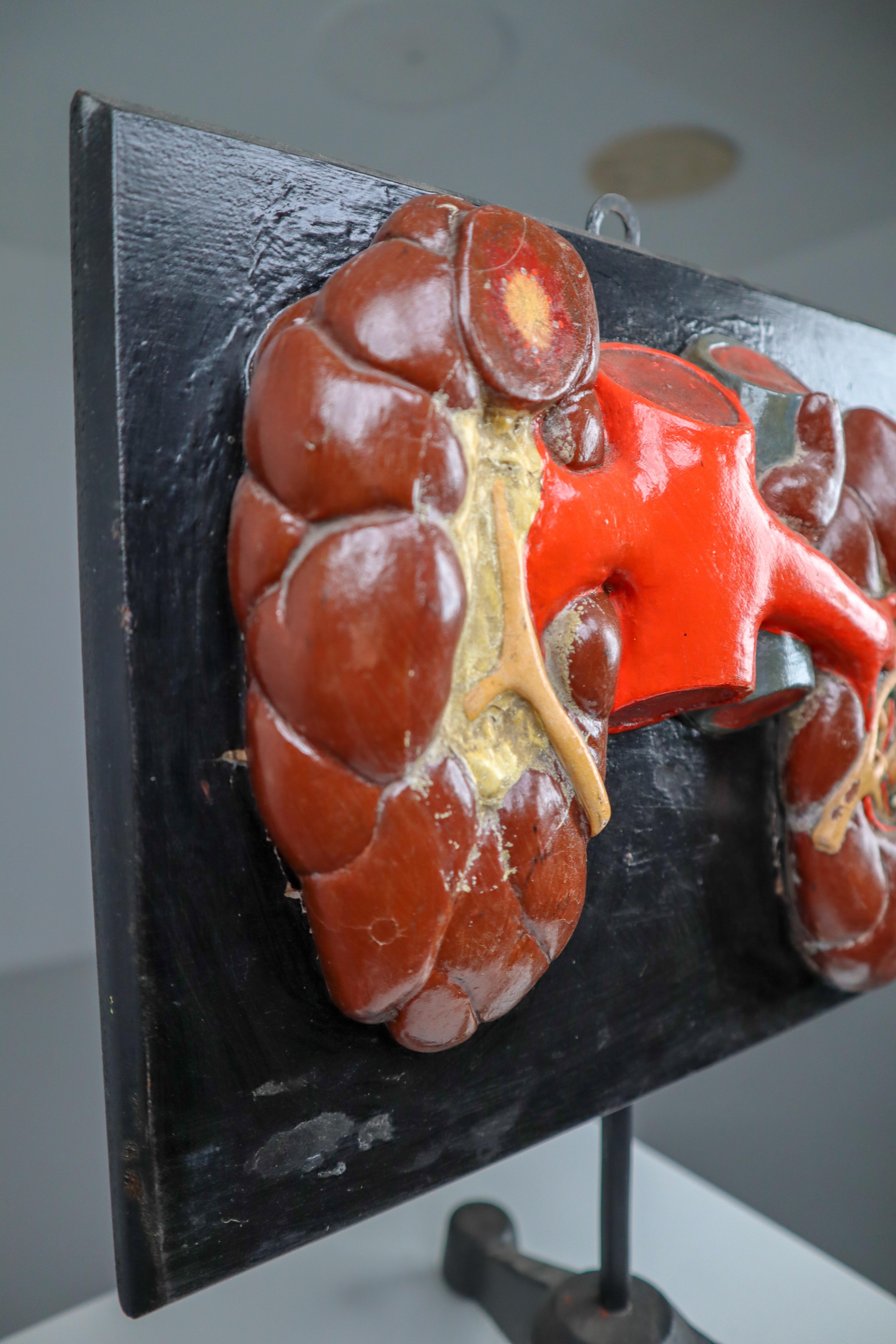 Kidneys Anatomical Model Wood and Plaster on Metal Base CZ, 1940s 6