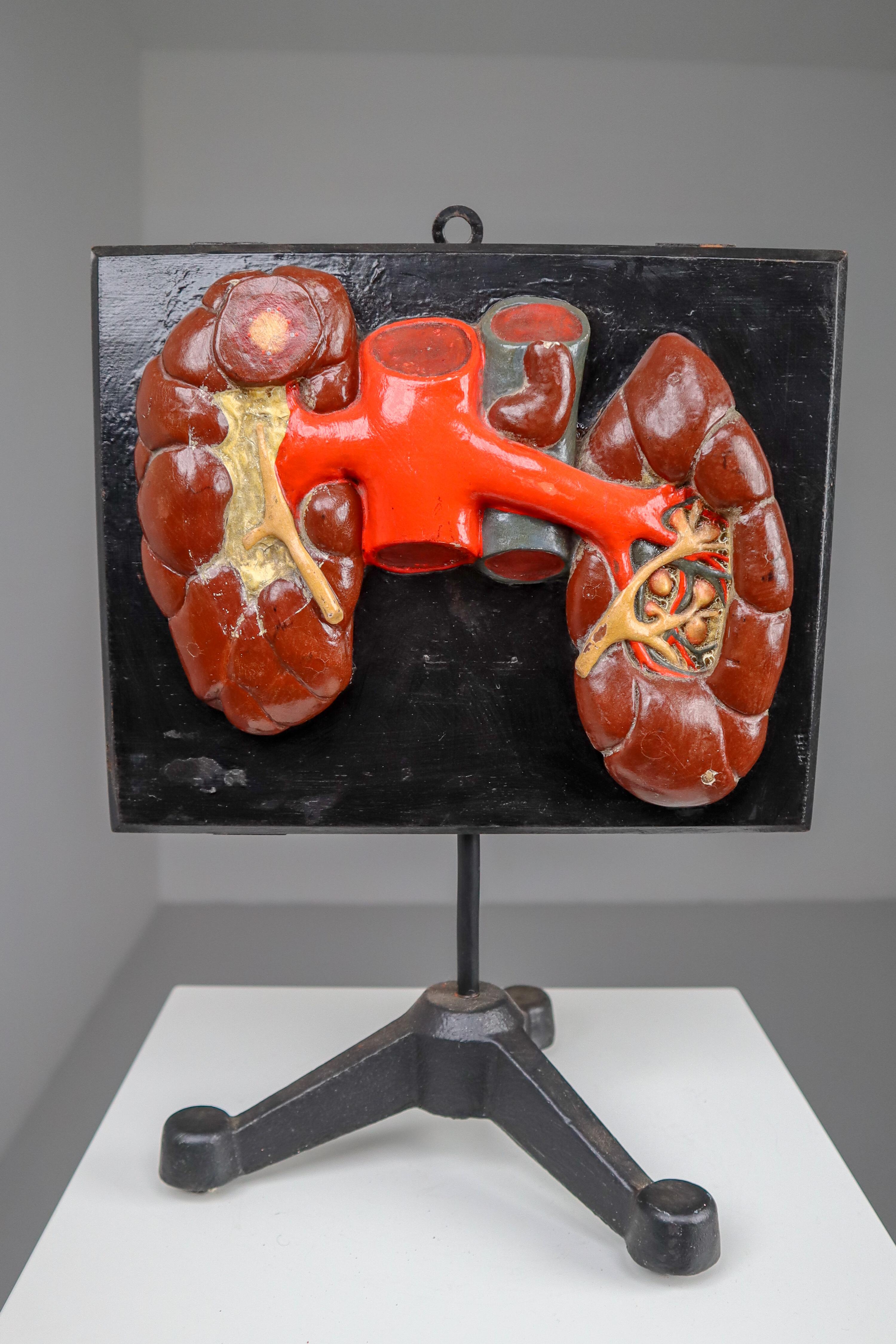 Kidneys anatomical model made from wood and plaster on metal base, Czech Republic, 1940s. Small damages and repairs. But overall great shape. Size: 11.5'' x H 16