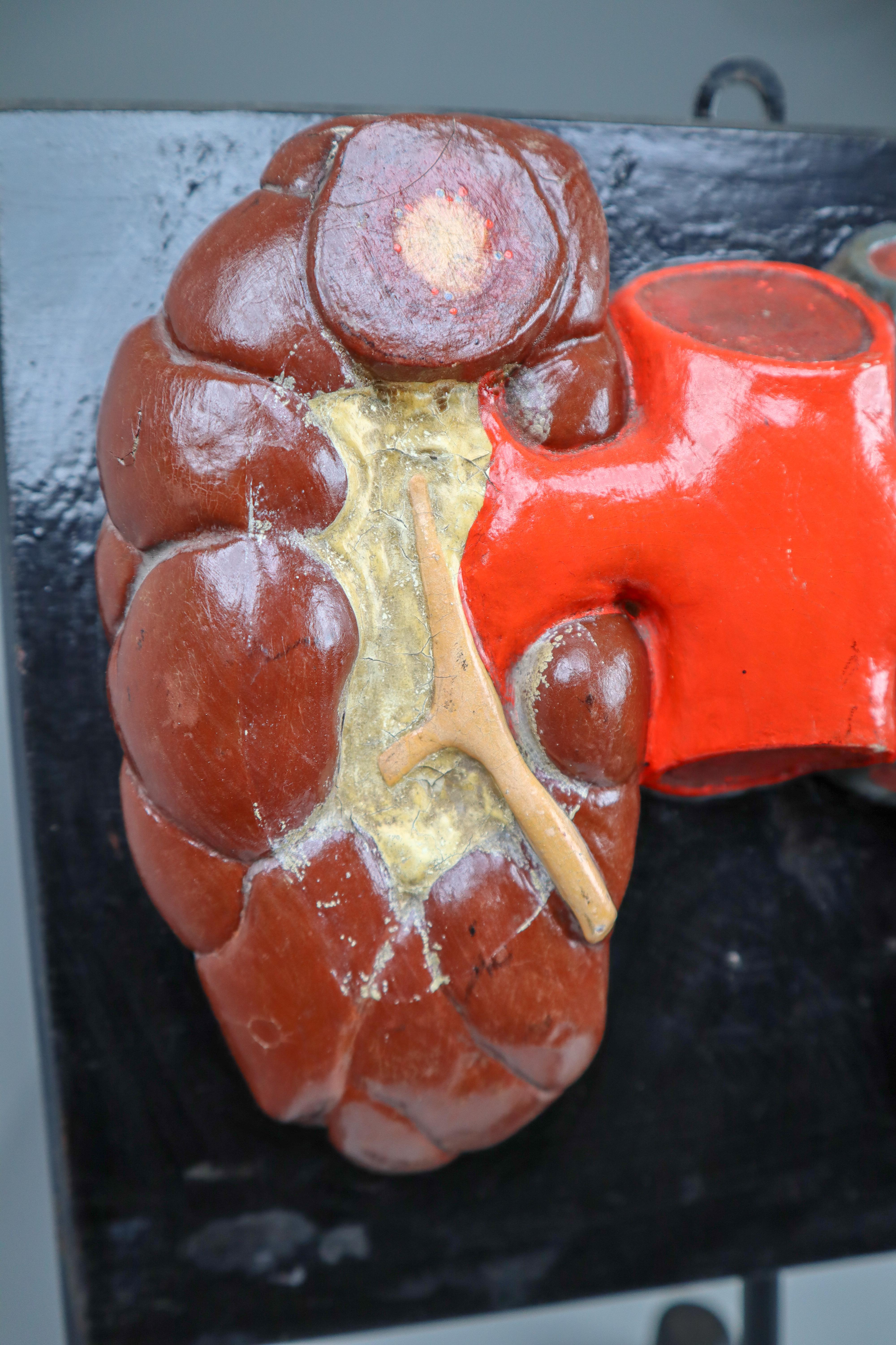 Czech Kidneys Anatomical Model Wood and Plaster on Metal Base CZ, 1940s