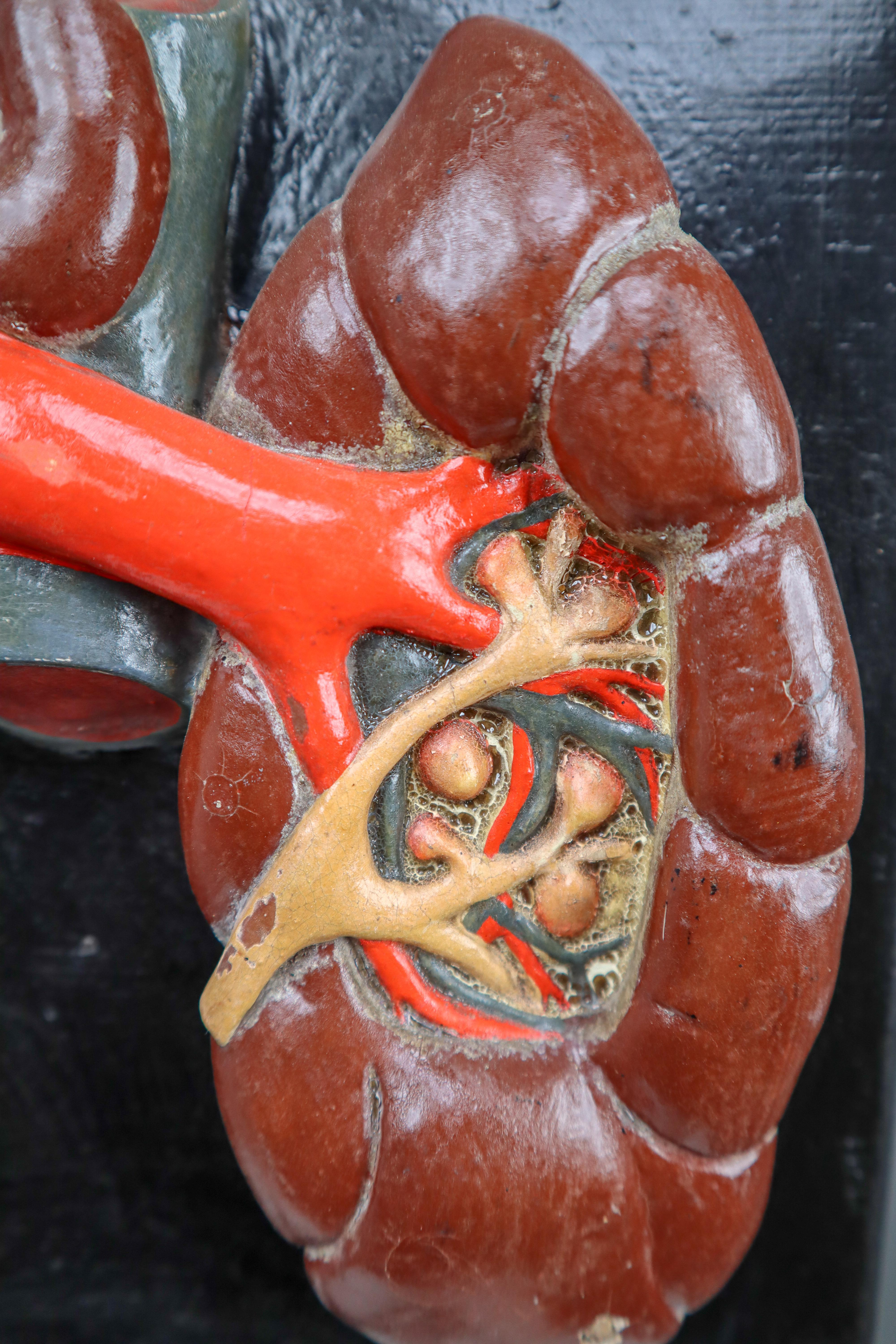 Kidneys Anatomical Model Wood and Plaster on Metal Base CZ, 1940s In Good Condition In Almelo, NL