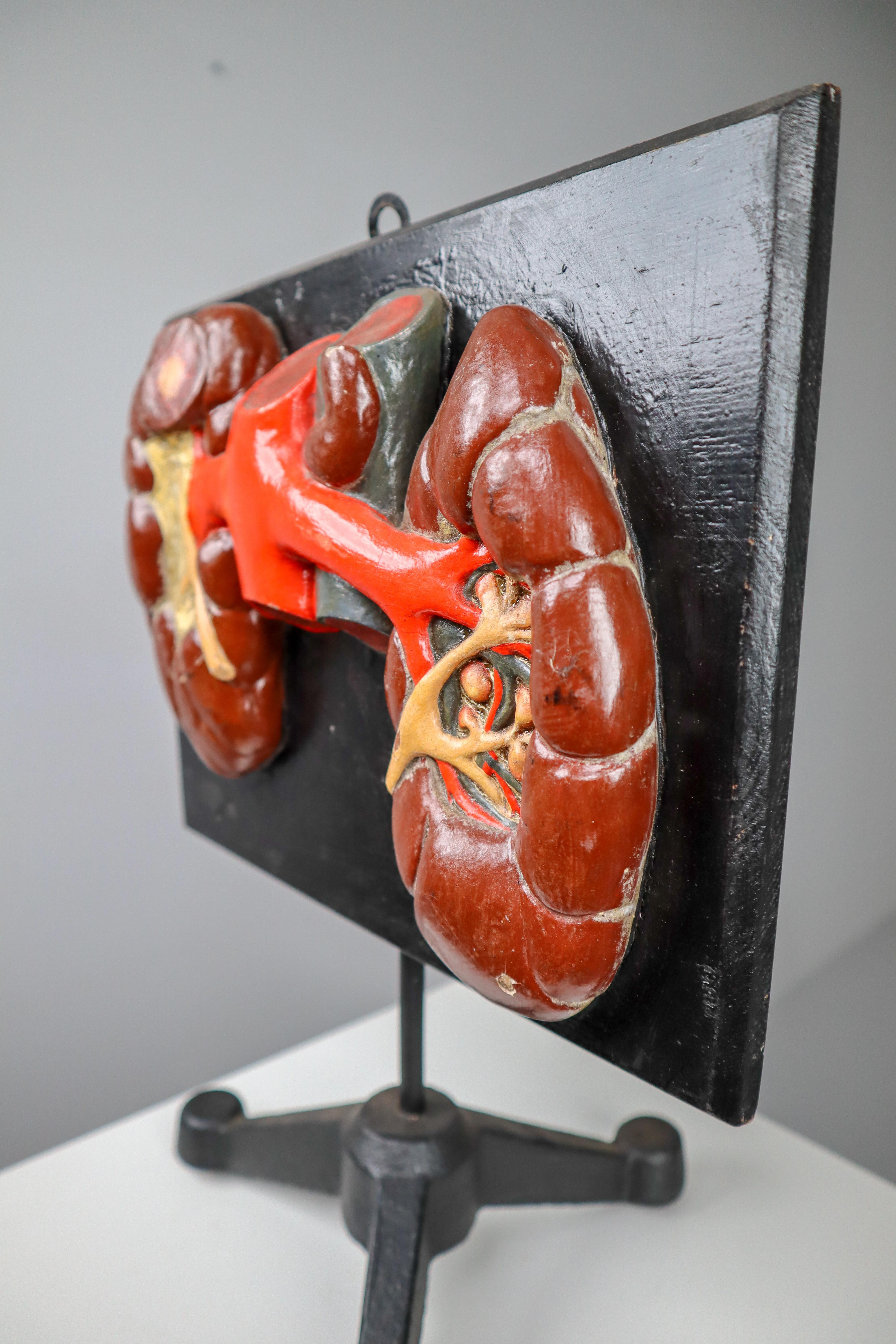 20th Century Kidneys Anatomical Model Wood and Plaster on Metal Base CZ, 1940s
