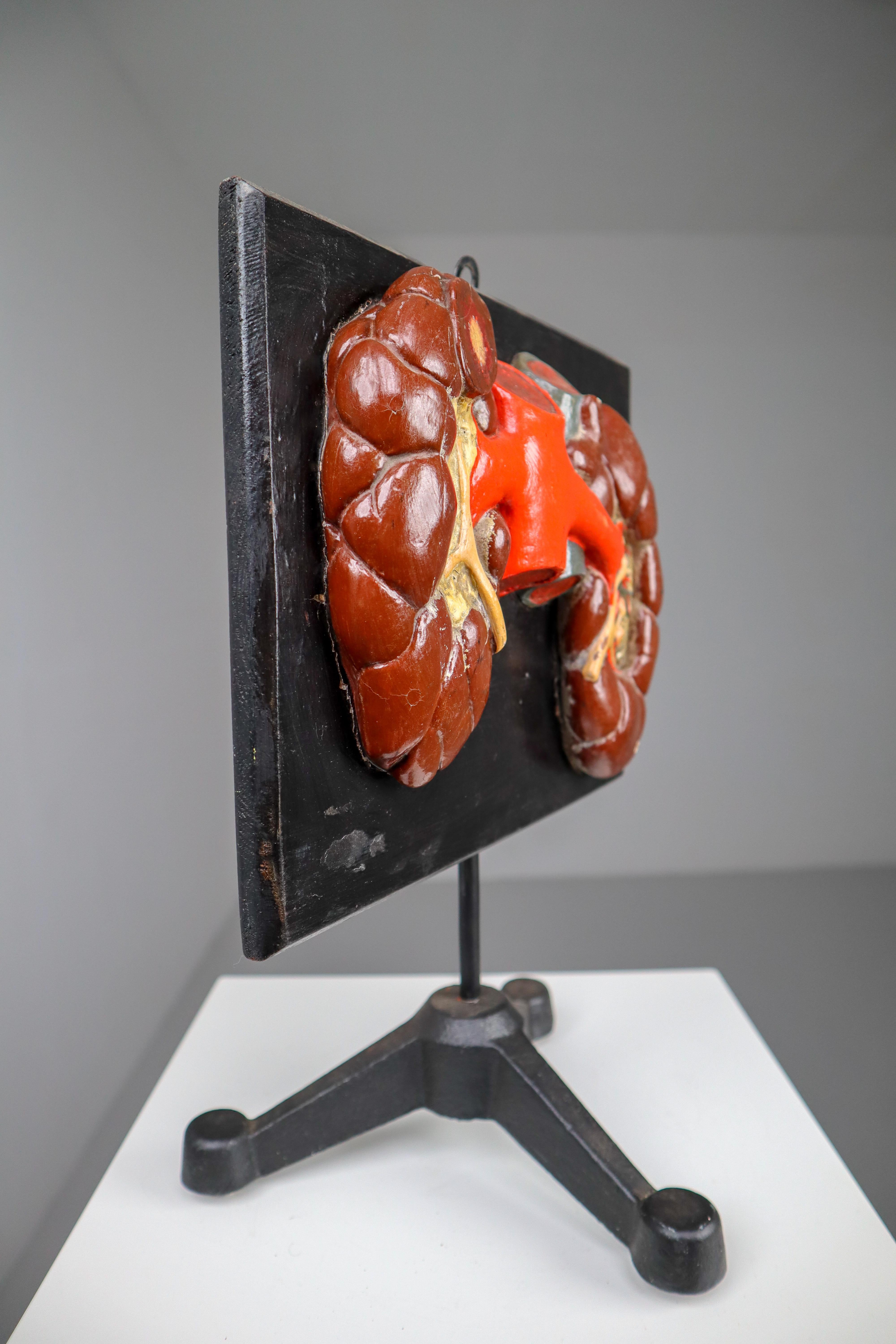 Kidneys Anatomical Model Wood and Plaster on Metal Base CZ, 1940s 1