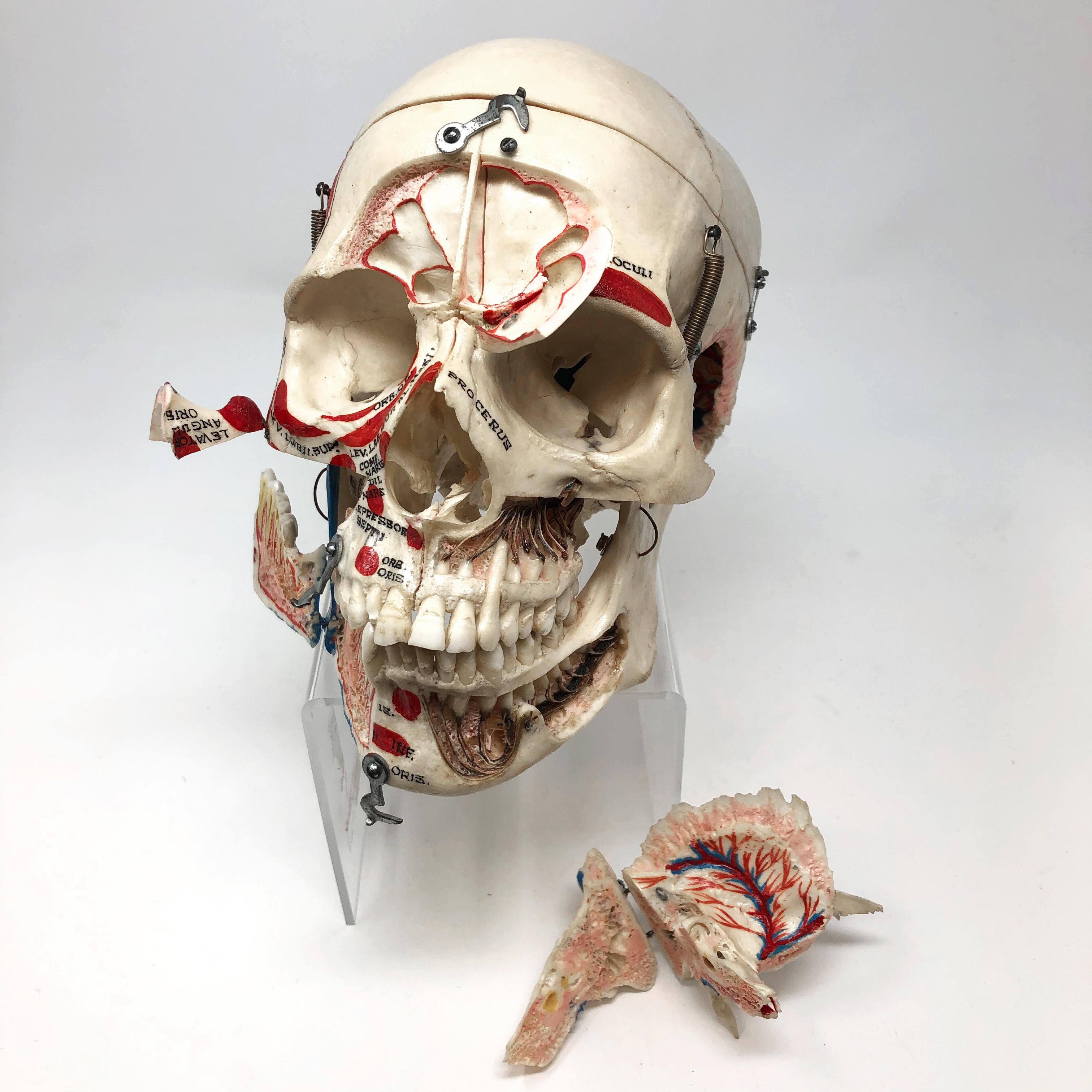 Kilgore Authentisches Anatomisches Präparat Menschlicher Schädel im Angebot 5