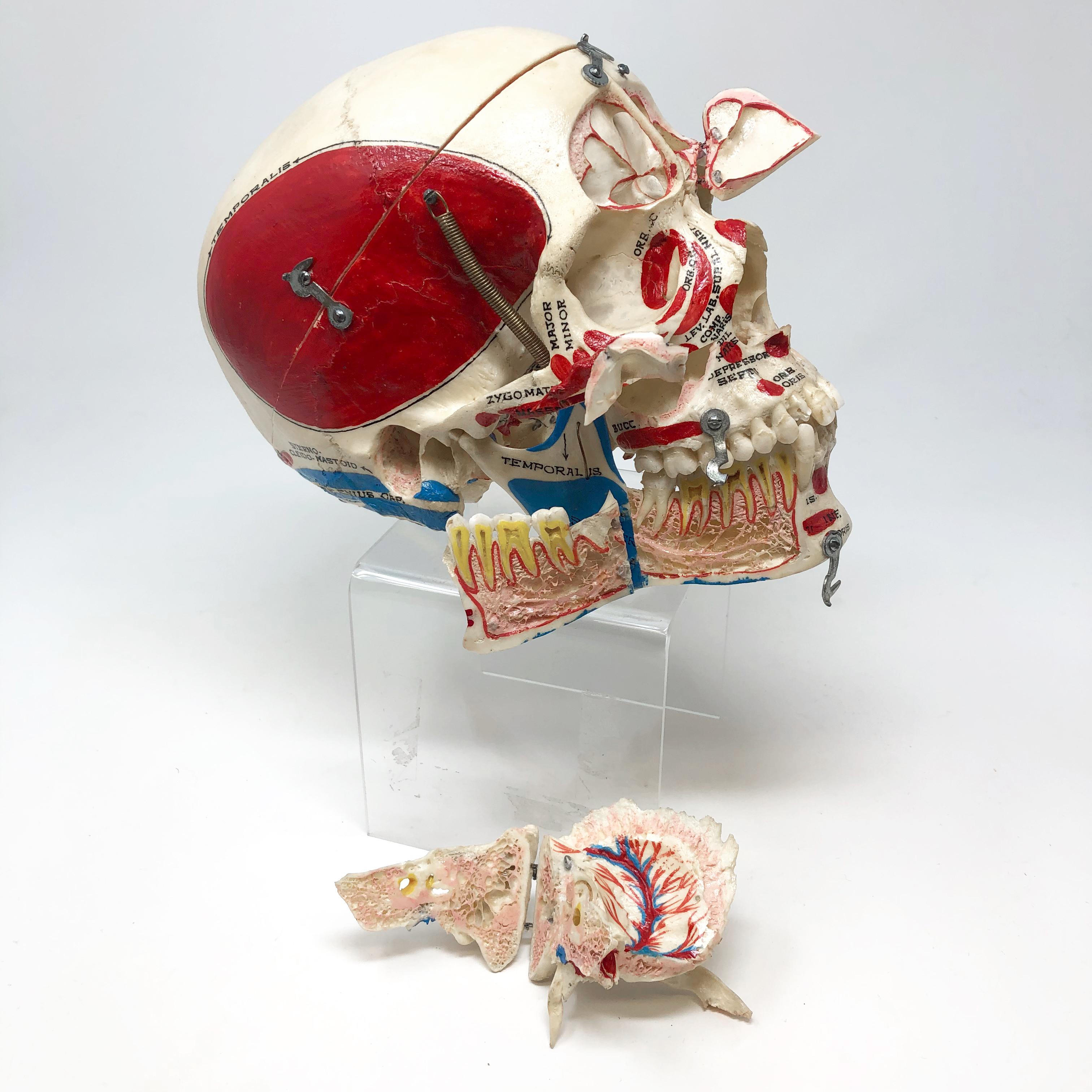 Kilgore Authentic Anatomical Preparation Human Skull For Sale 3