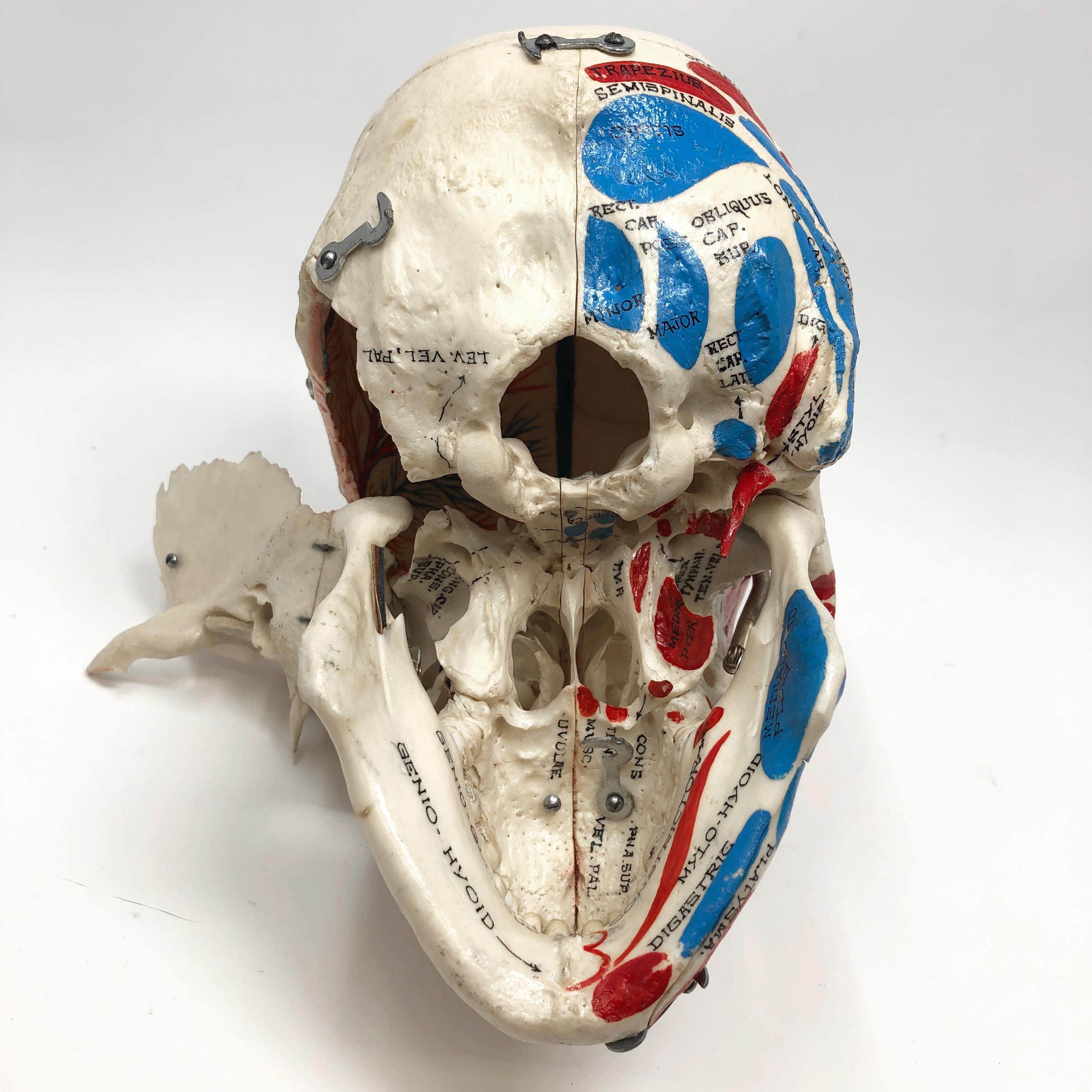 Kilgore Authentisches Anatomisches Präparat Menschlicher Schädel im Angebot 7