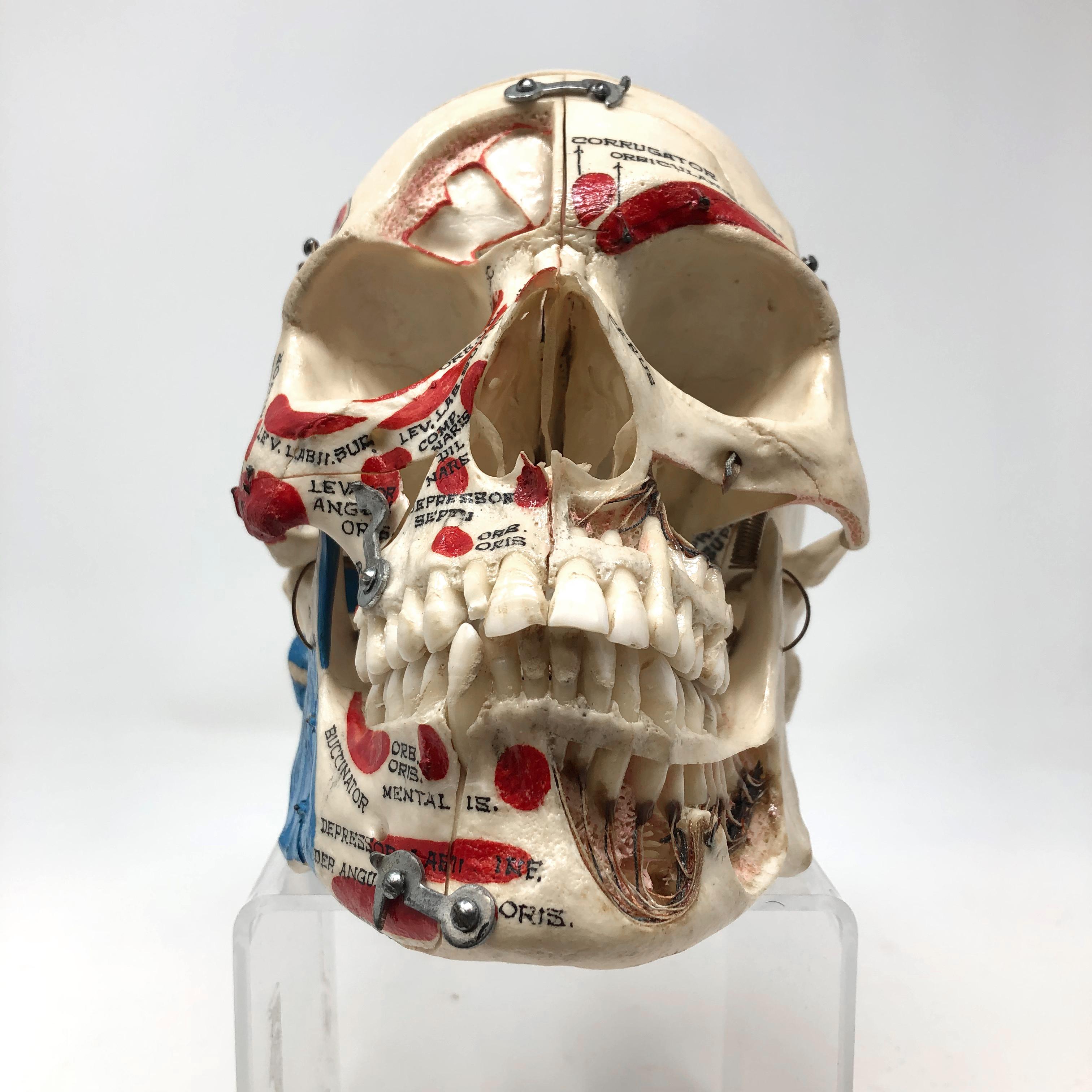 Prepared by legendary medical supply company Kilgore International, this is an advanced anatomical reference human skull! 

An exceptional authentic vintage example, this human skull has been meticulously labeled inside and out to create an