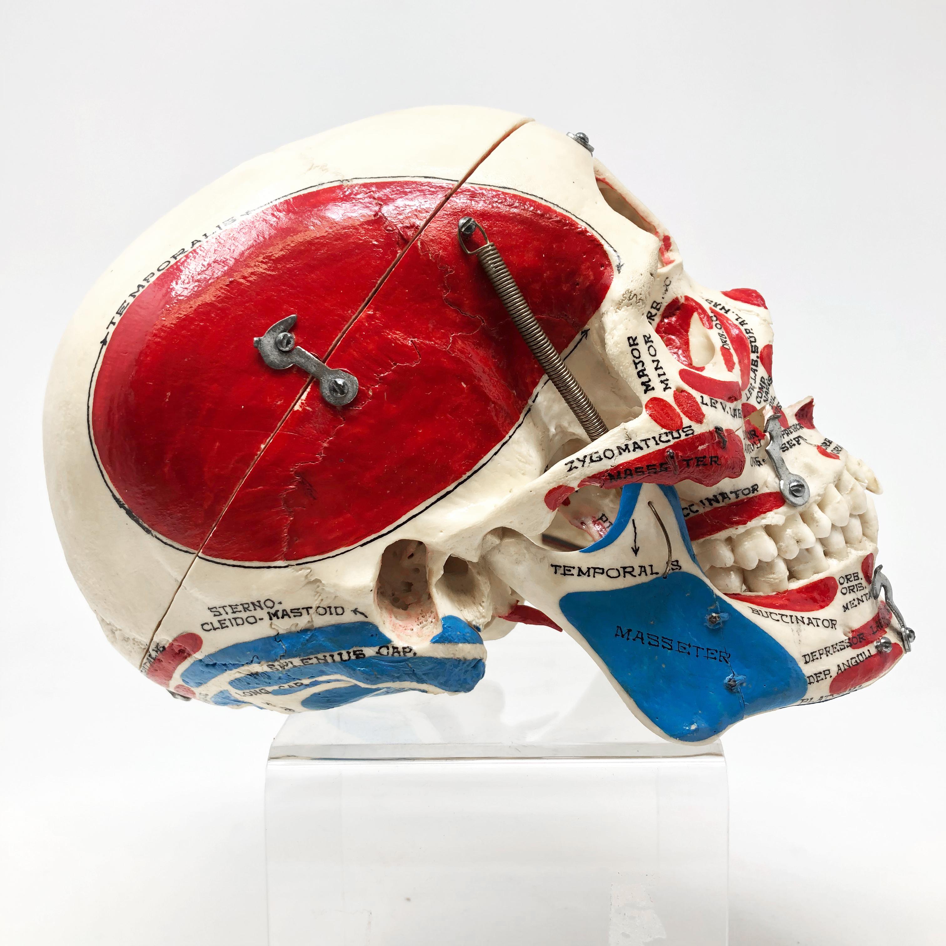 Kilgore Authentic Anatomical Preparation Human Skull In Good Condition For Sale In Hamilton, Ontario