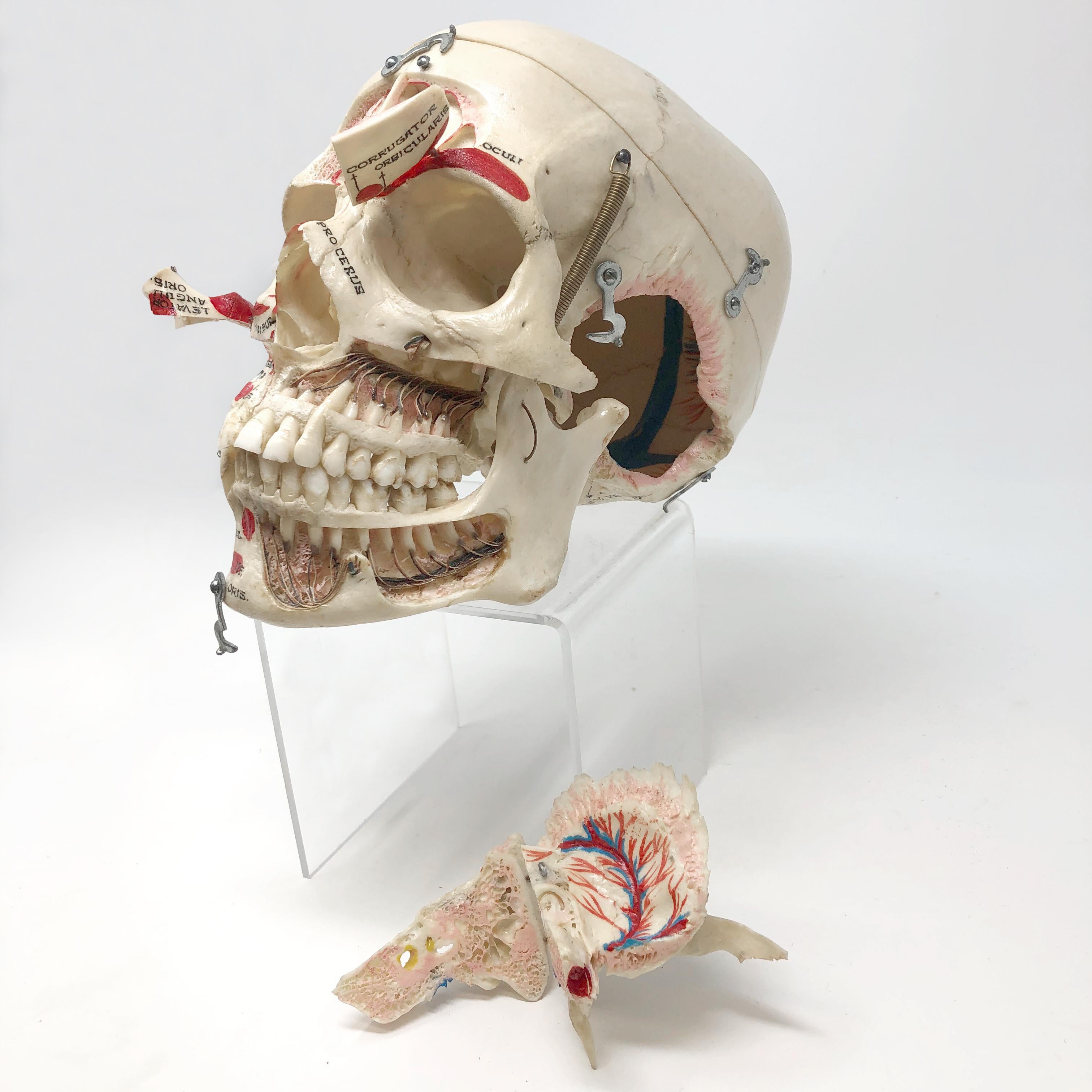 Bone Kilgore Authentic Anatomical Preparation Human Skull For Sale
