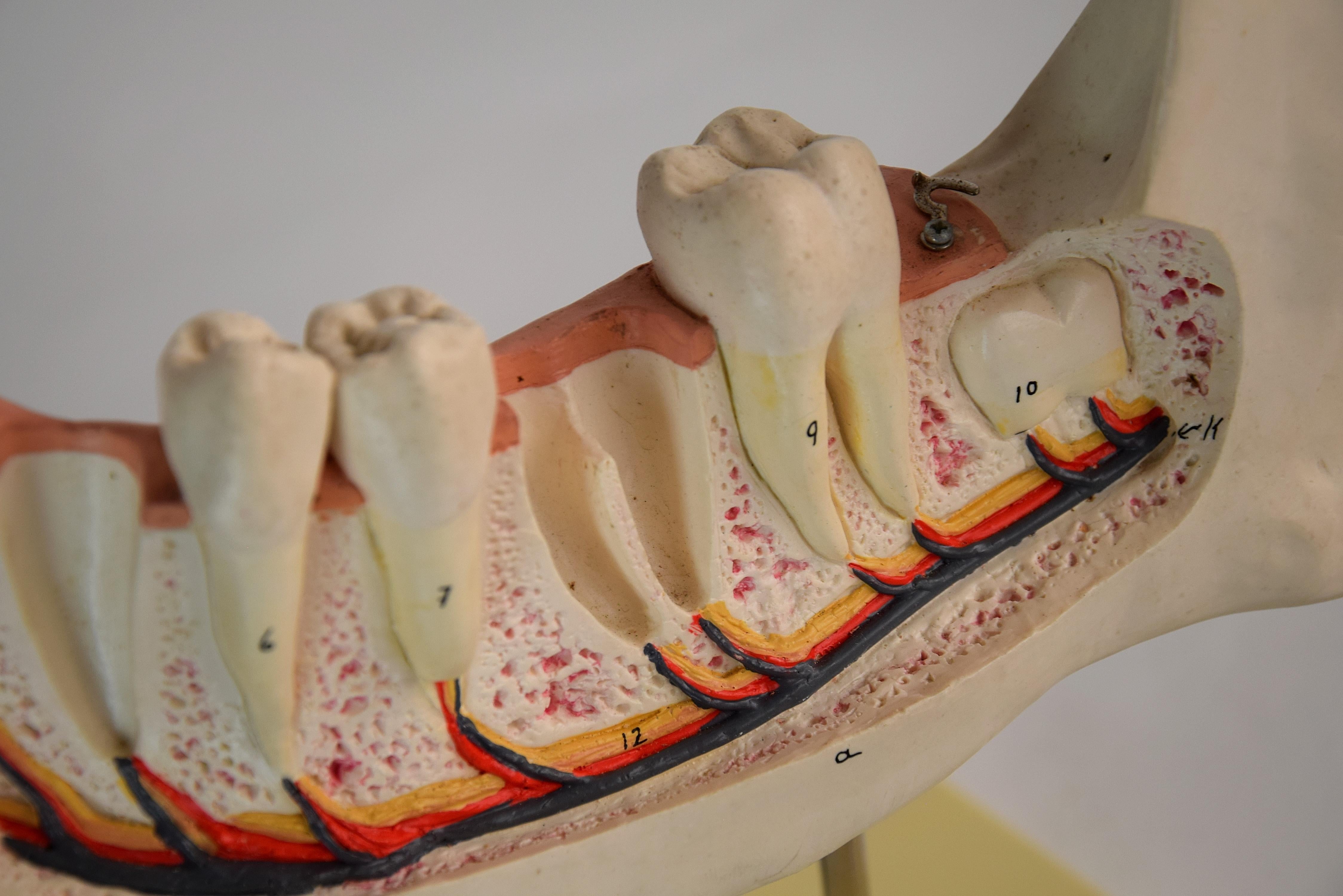 Large Mid-Century Modern Didactic Resin Anatomical Model Jaw For Sale 5