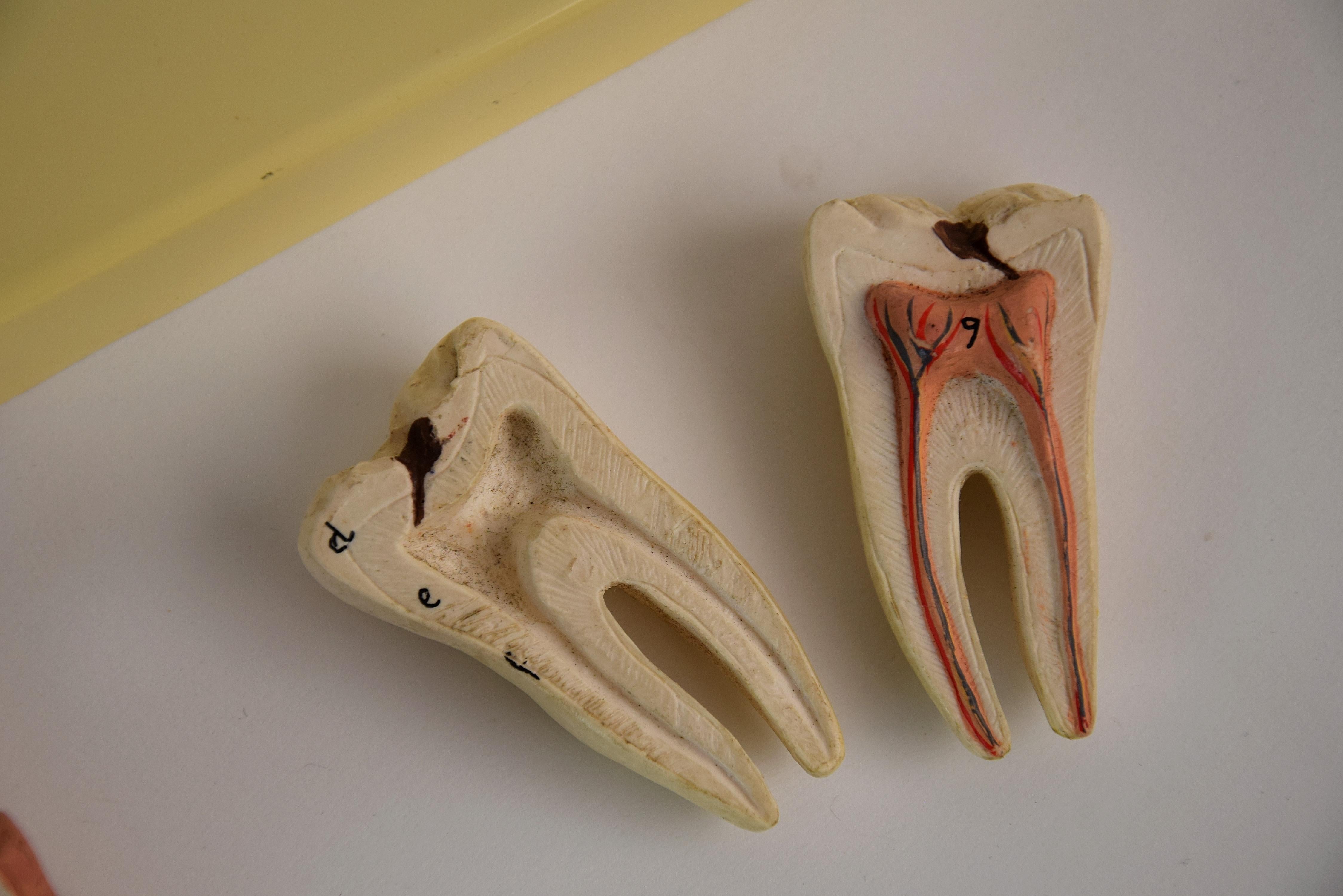 Anatomisches Mid-Century-Modern-Modell Jaw aus Didactic Resin im Angebot 5