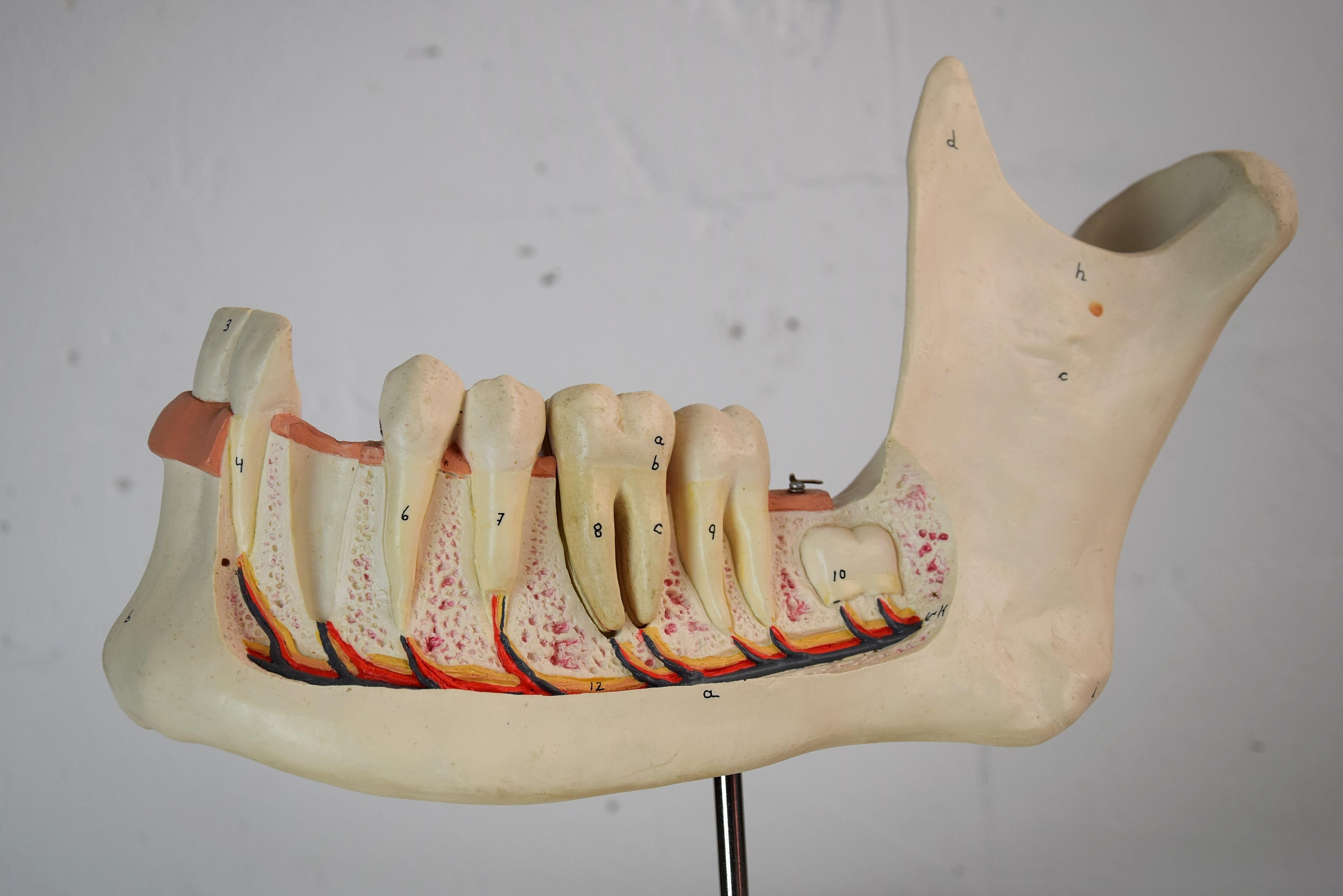 Large Mid-Century Modern Didactic Resin Anatomical Model Jaw For Sale 1