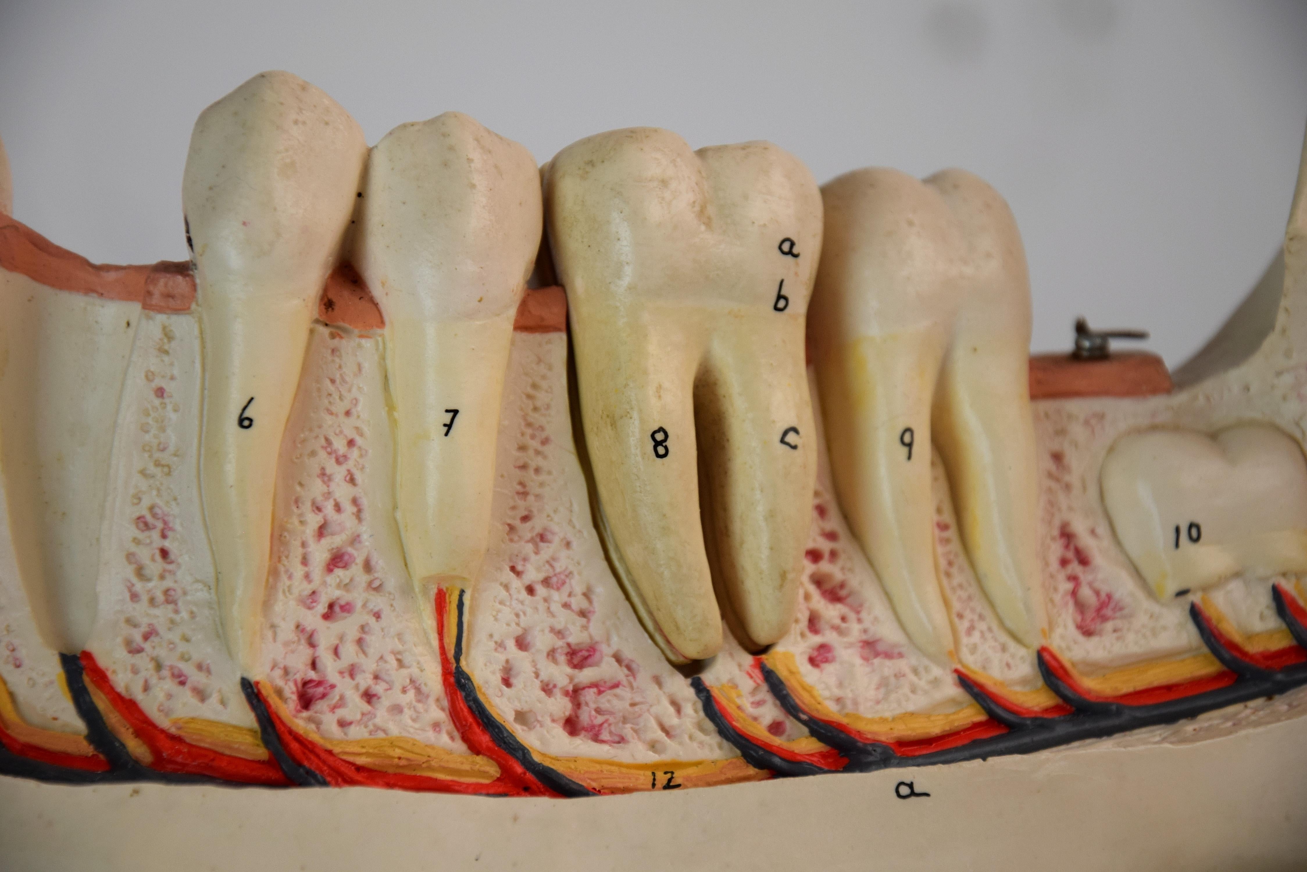 Large Mid-Century Modern Didactic Resin Anatomical Model Jaw For Sale 2