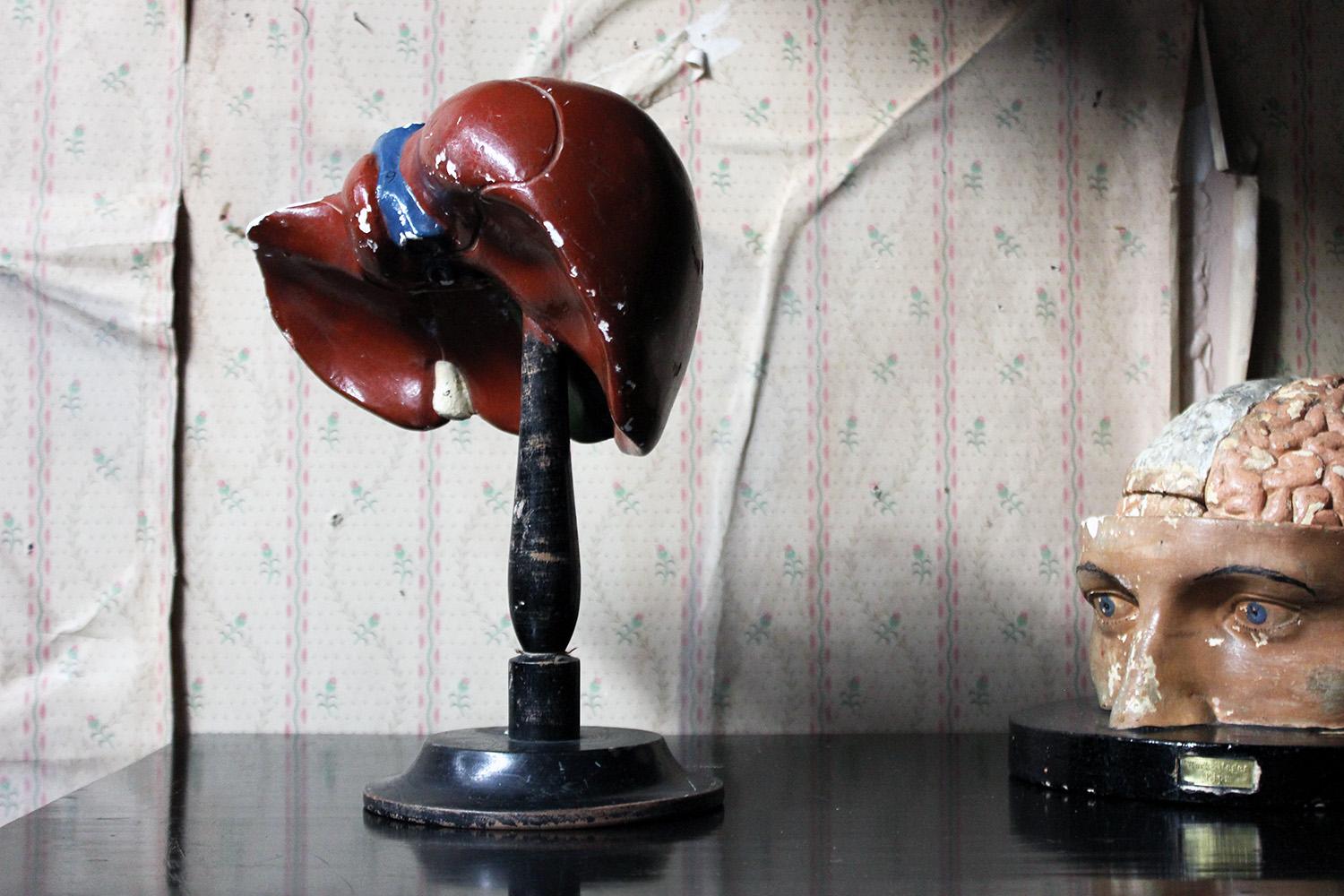 The cast and moulded polychrome painted didactic model of the human liver on a turned ebonized stand, the model being plaster and hand painted with detailed numbered regions of the liver, made by either Bock Steger or Marcus Sommer in late 19th