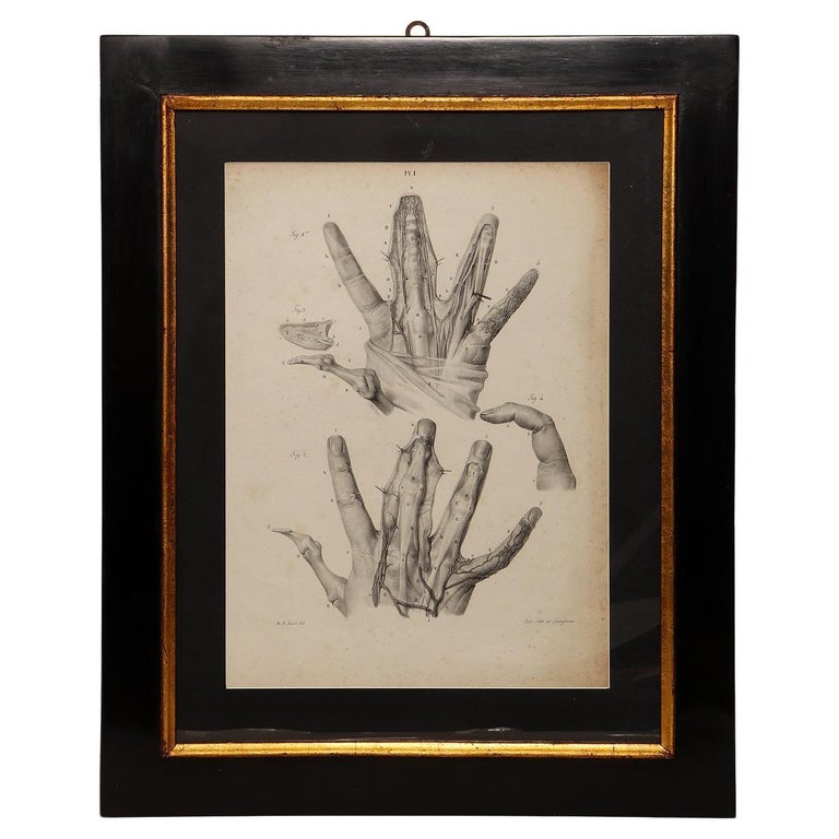 Lithographic print on paper, depicting the atlas of the hand, France