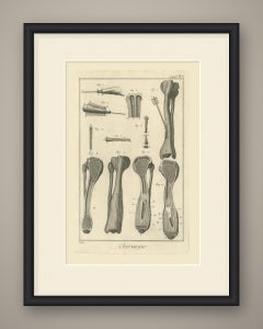 Long Bone Sections, Diderot Chirurgie Supplement Plate 7, circa 1778