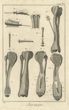 Long Bone Sections, Diderot Chirurgie Supplement Plate 7, circa 1778