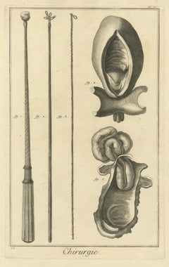 Long Probes and Anatomical Specimens, Diderot Chirurgie Plate V, circa 1772