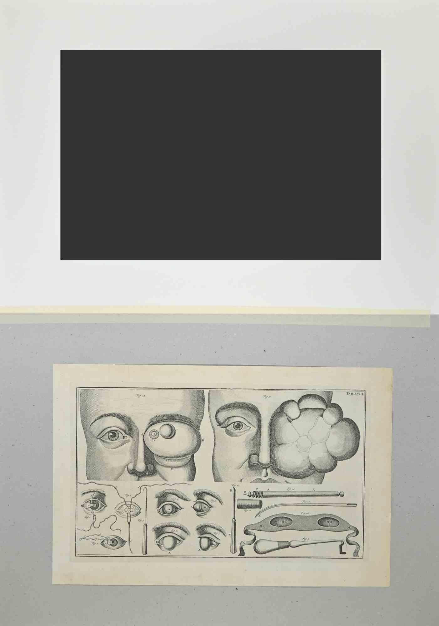 Surgery of the Eye - Etching by Lorenz Heister - 1750 For Sale 1