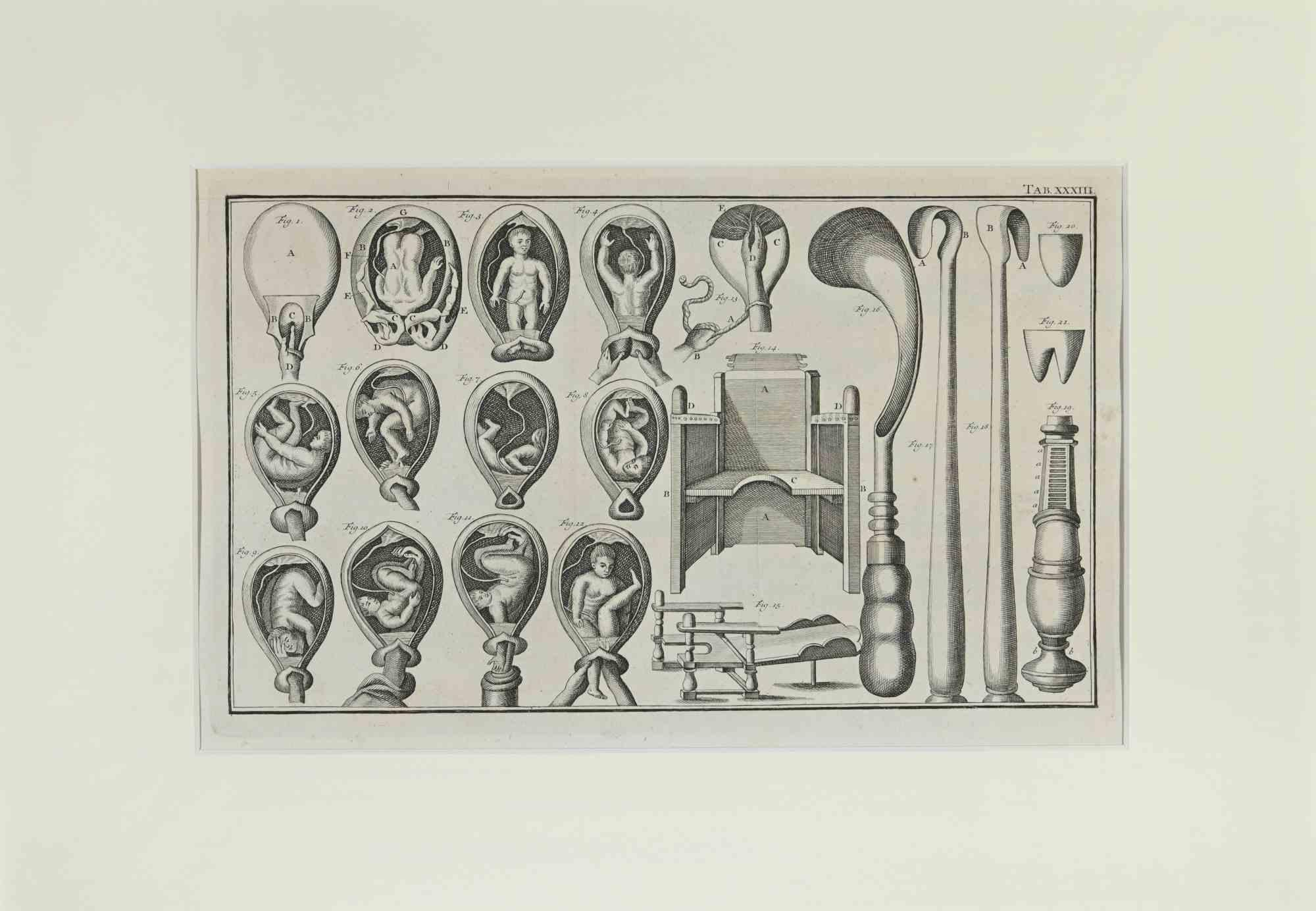 Surgical Instruments s part of the suite realized by Lorenz Heister in the series of Institutiones Chirurgicae, Amsterdam, Janssonius-Waesberg, 1750.

Etching on paper.

The work belongs to the Latin edition of the famous work by the founder of