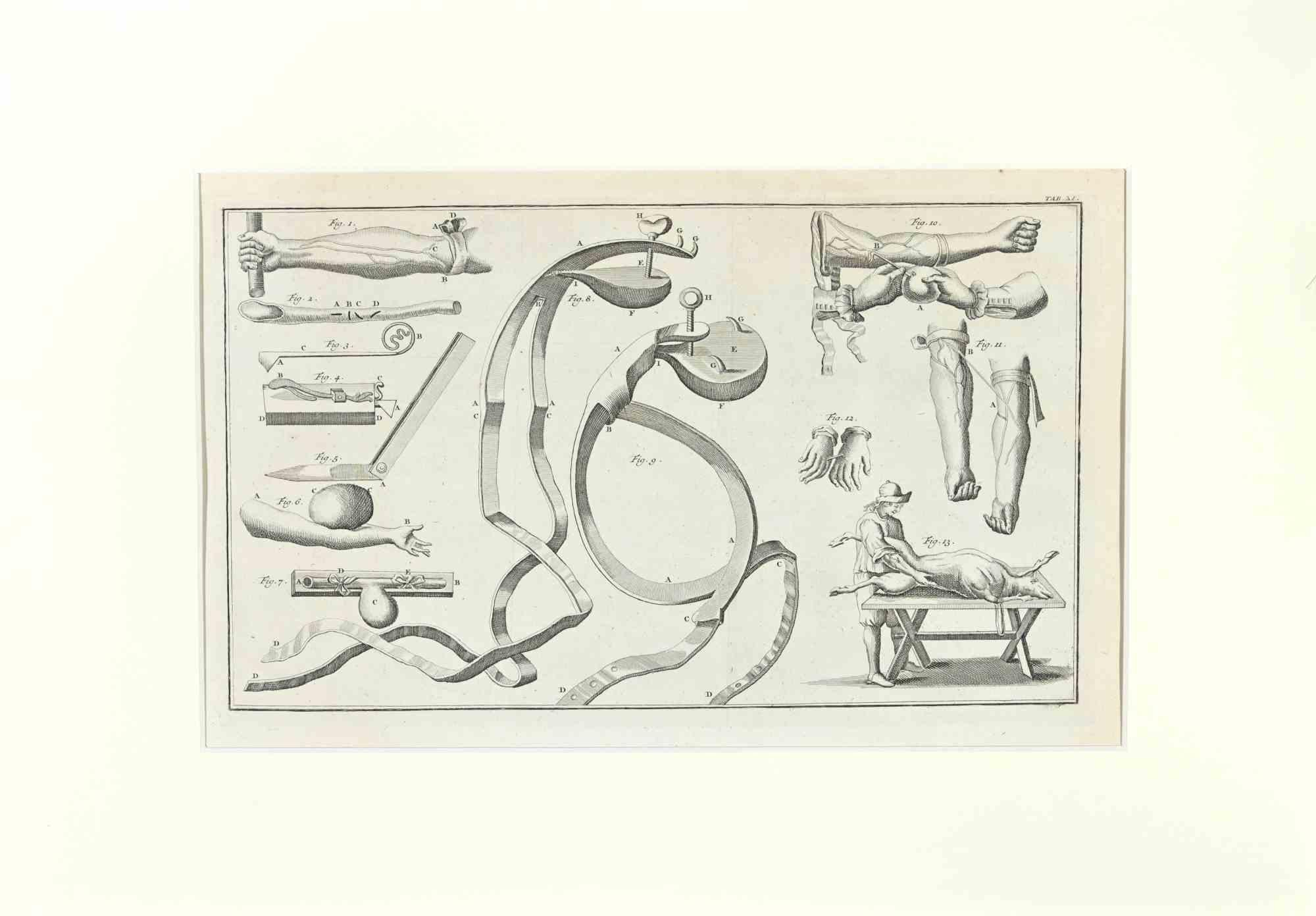 Instruments chirurgicaux fait partie de la suite réalisée par Lorenz Heister dans la série des Institutiones Chirurgicae, Amsterdam, Janssonius-Waesberg, 1750.

Gravure sur papier.

L'ouvrage fait partie de l'édition latine du célèbre ouvrage du