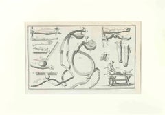 Antique Surgical Instruments - Etching by Lorenz Heister - 1750